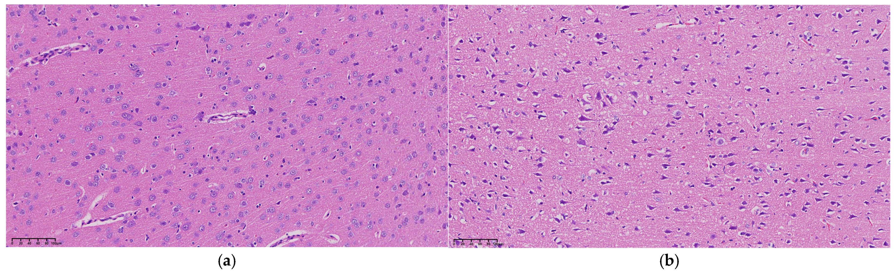 Brainsci 14 01175 g005a