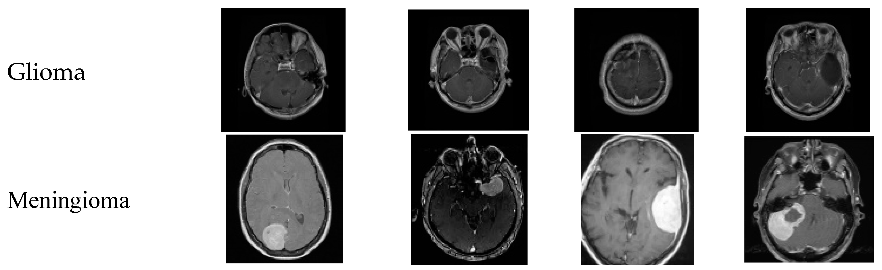 Brainsci 14 01178 g004a