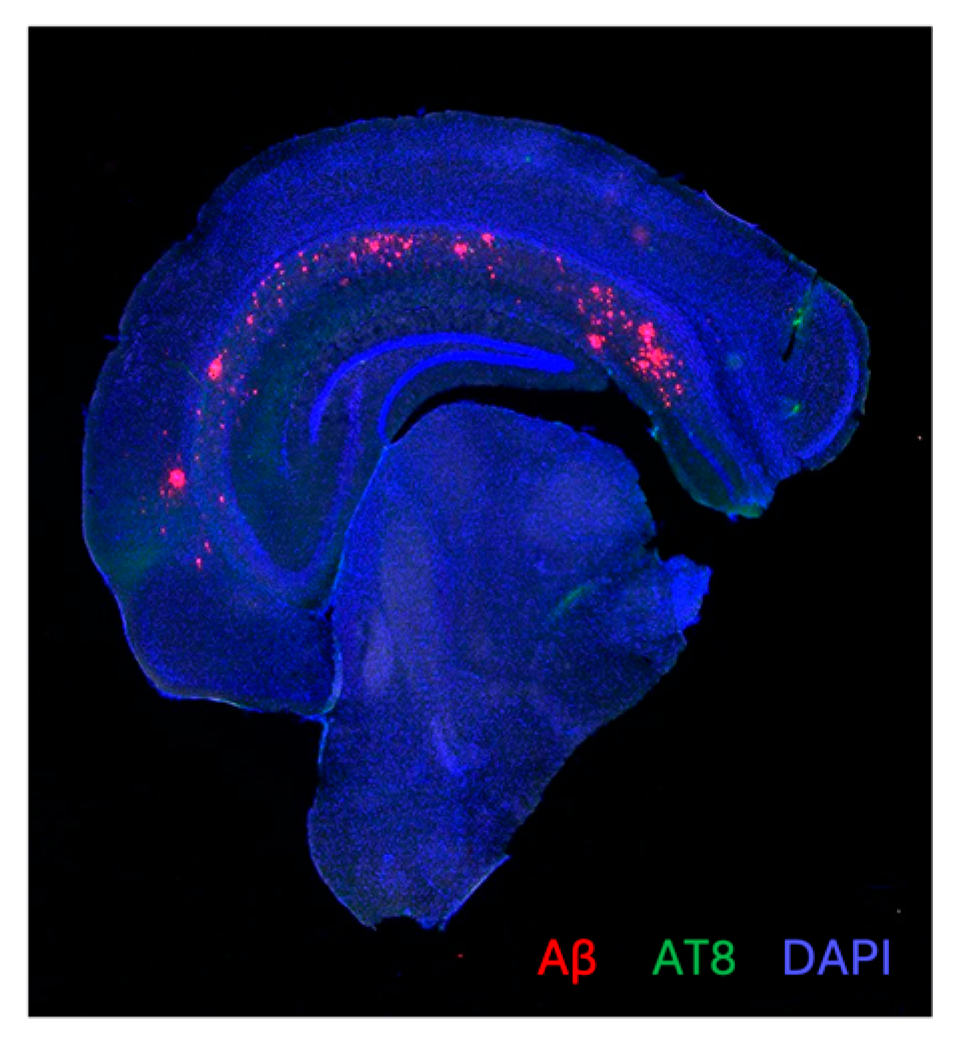 Brainsci 14 01186 g001