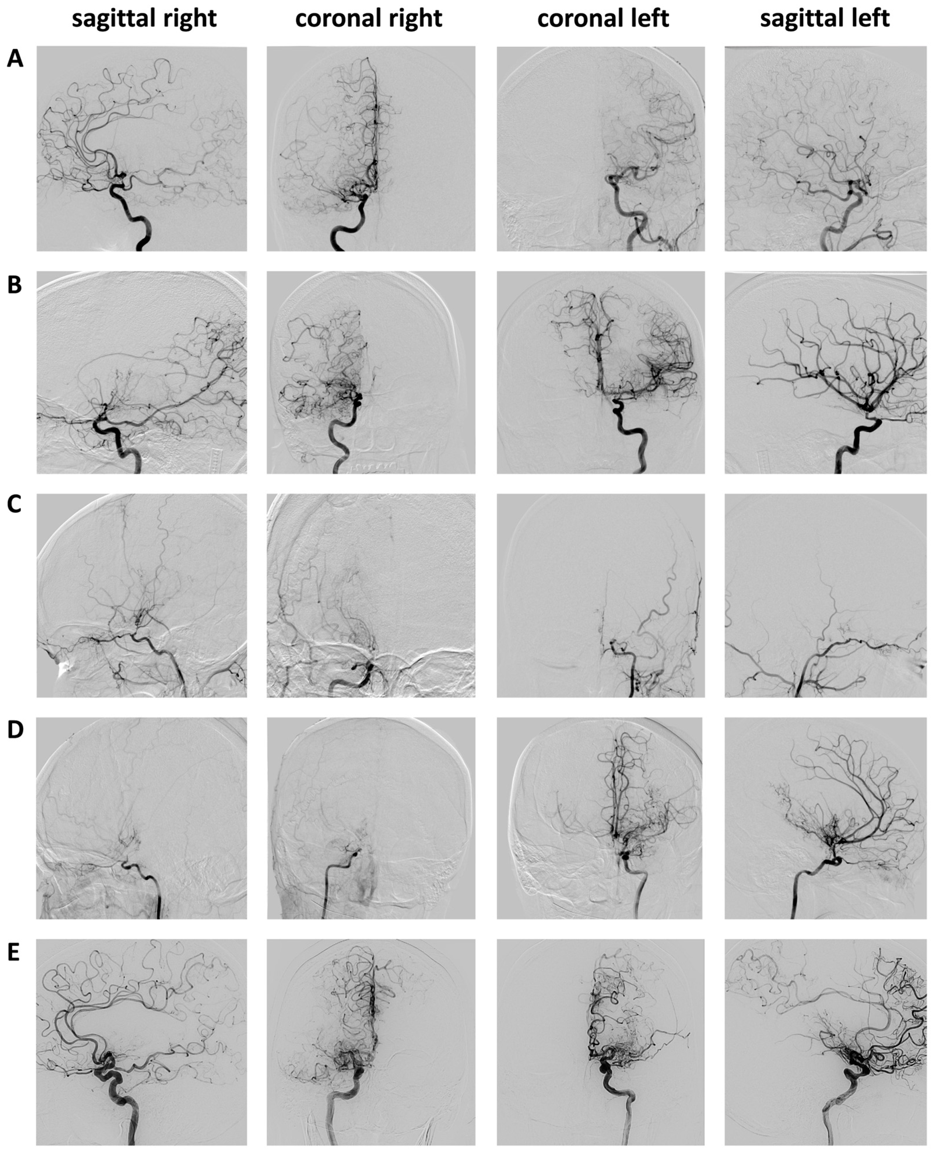 Brainsci 14 01190 g002