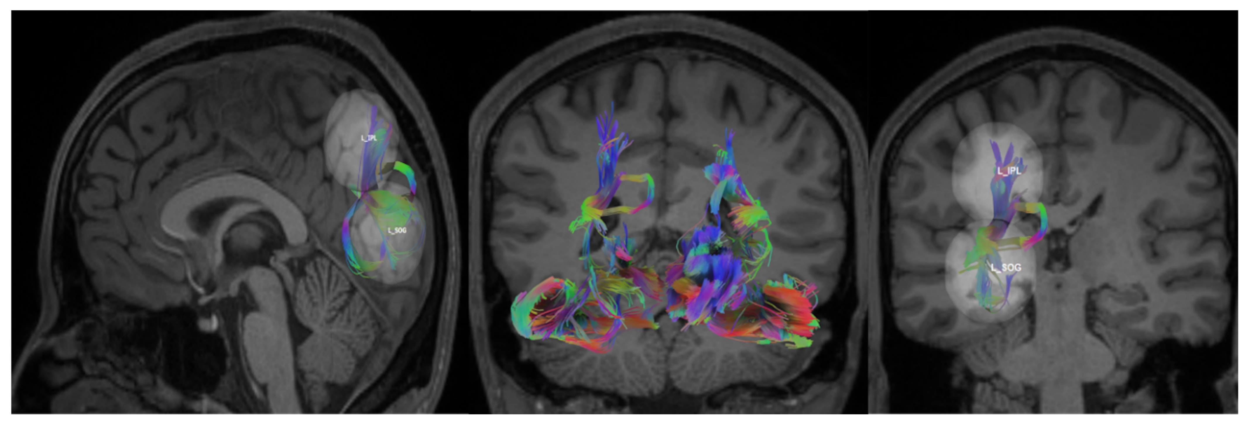 Brainsci 14 01206 g002 Brainsci 14 01206 g002