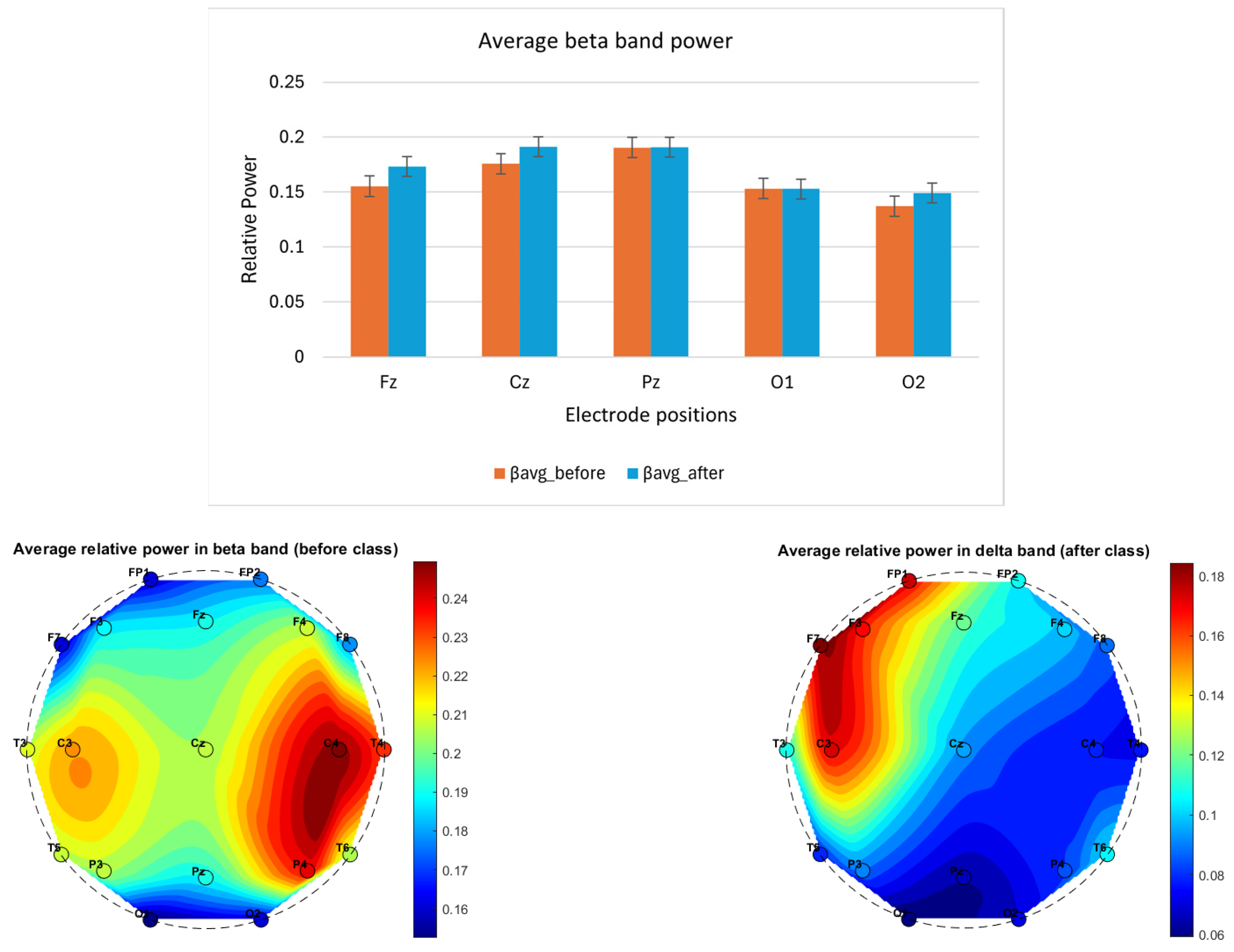 Brainsci 14 01215 g005