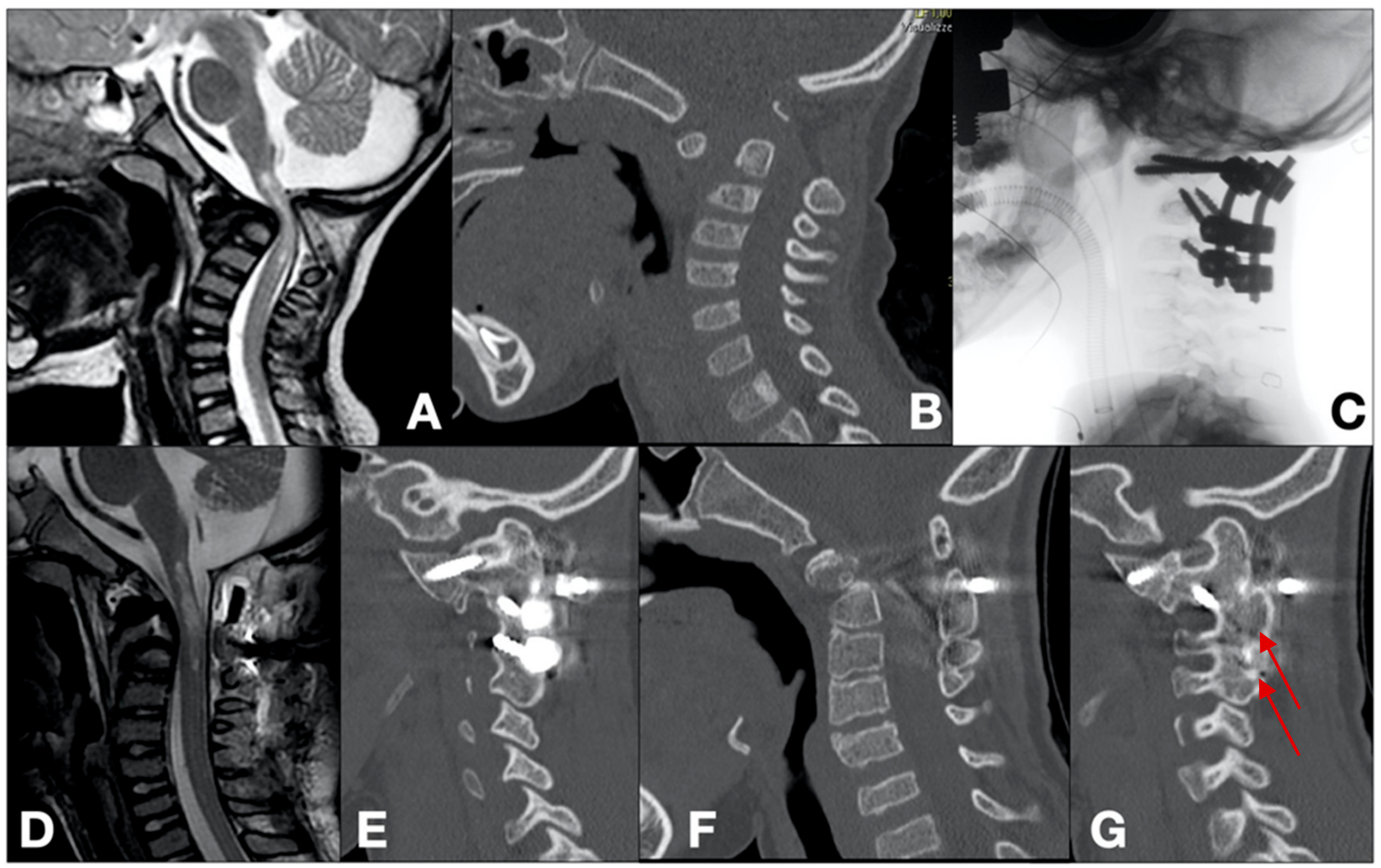 Brainsci 14 01228 g002