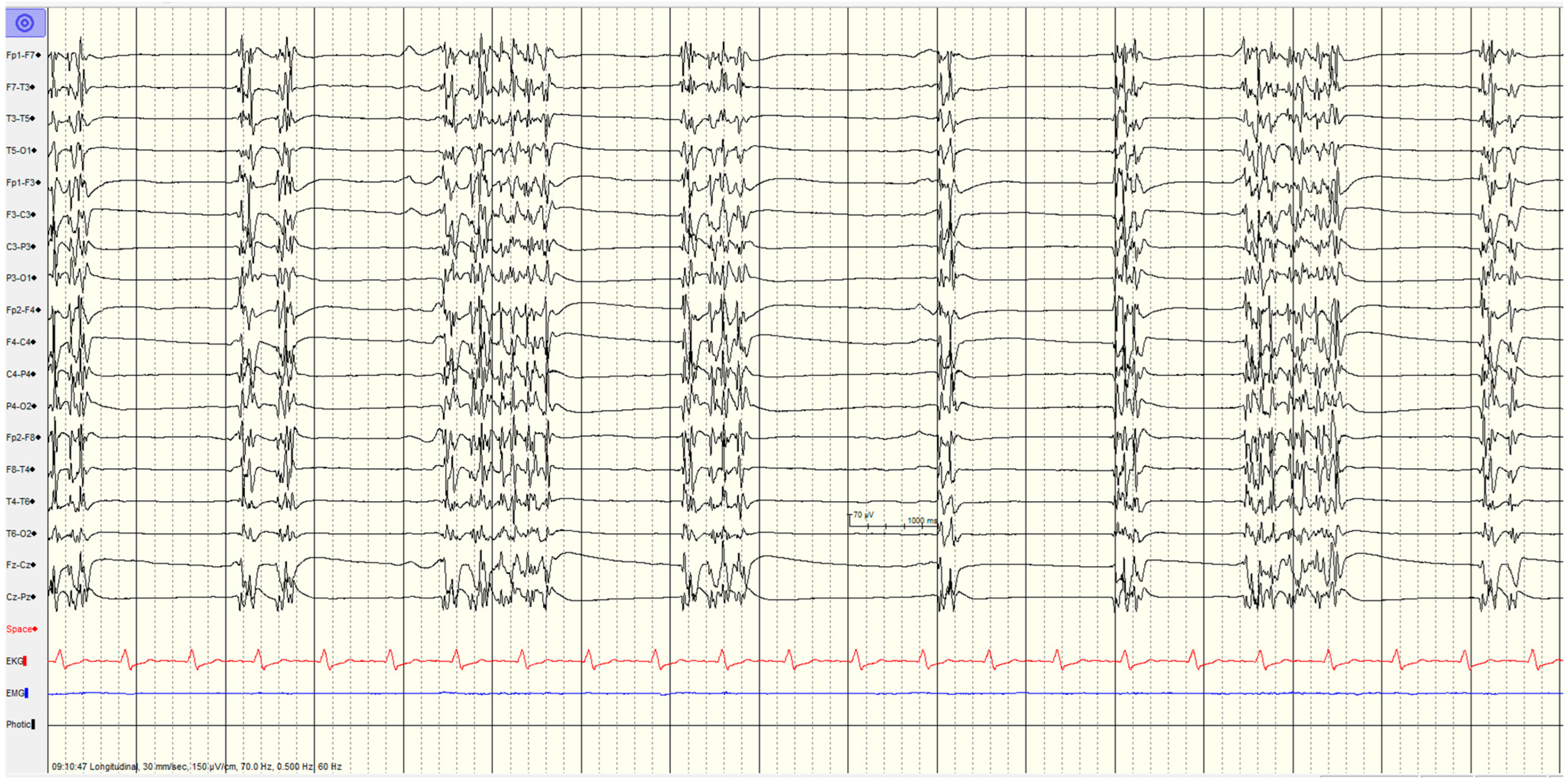 Brainsci 14 01264 g003