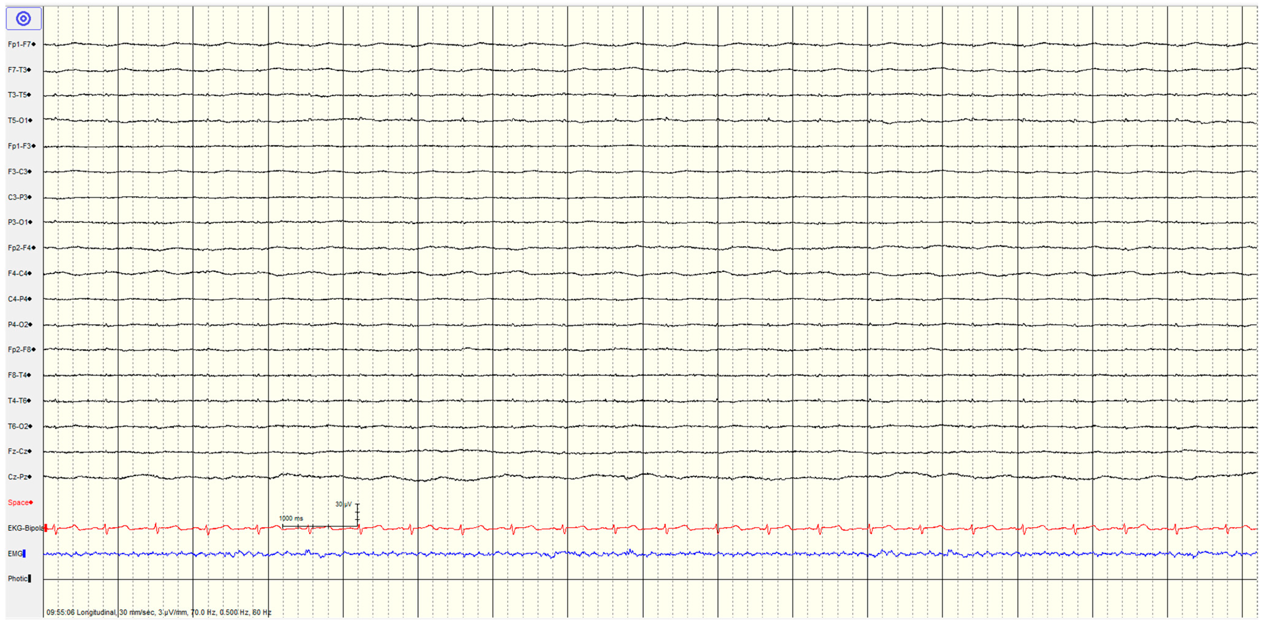 Brainsci 14 01264 g004