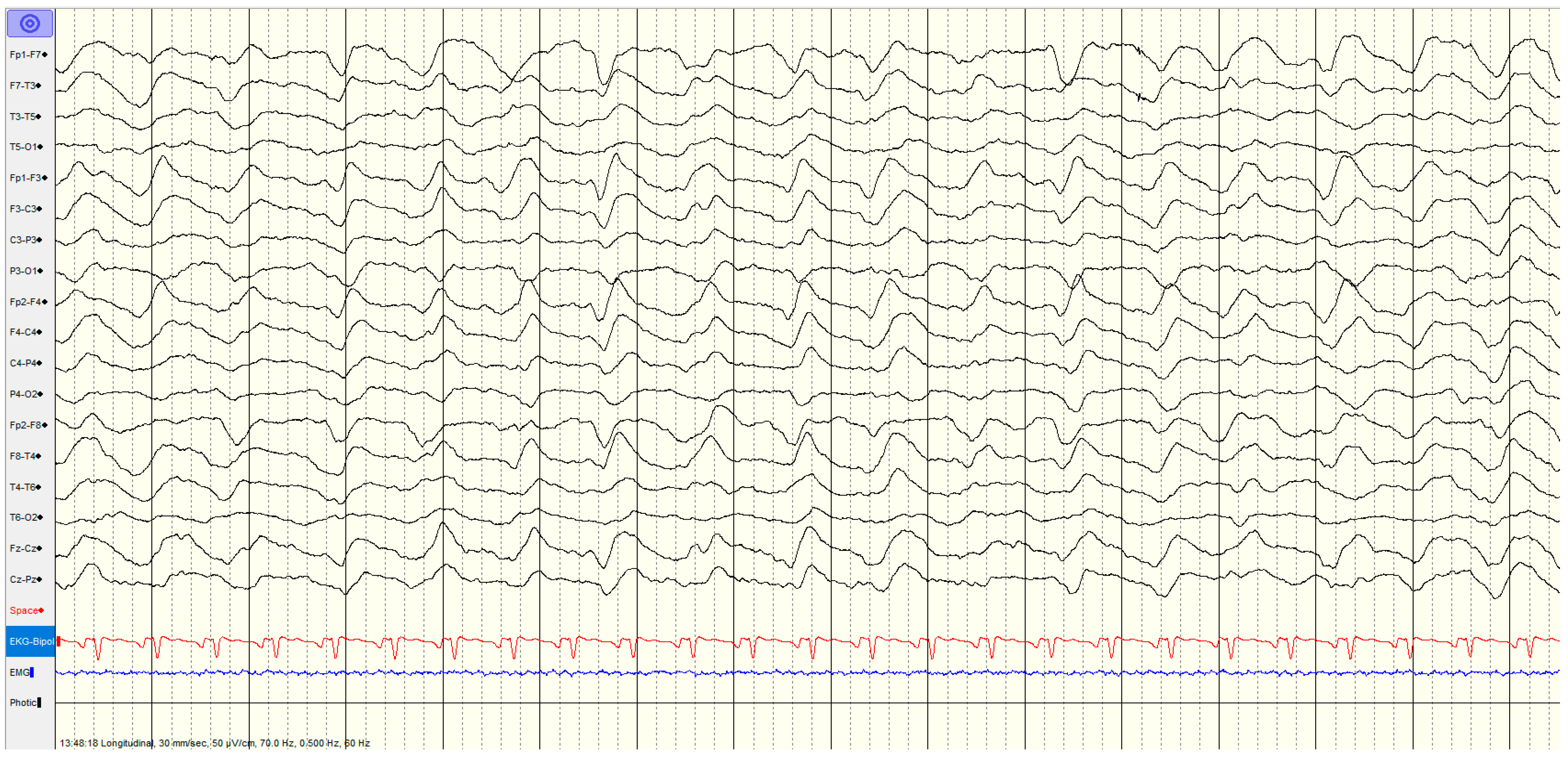 Brainsci 14 01264 g006