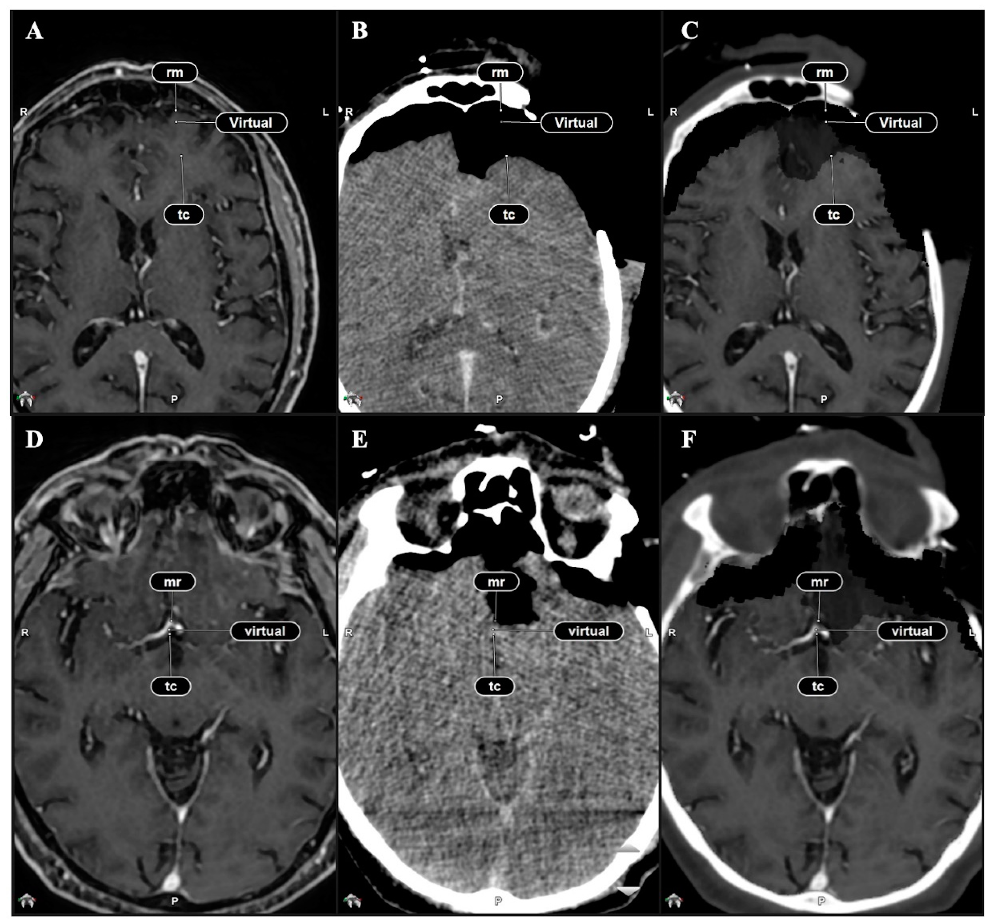 Brainsci 15 00035 g001