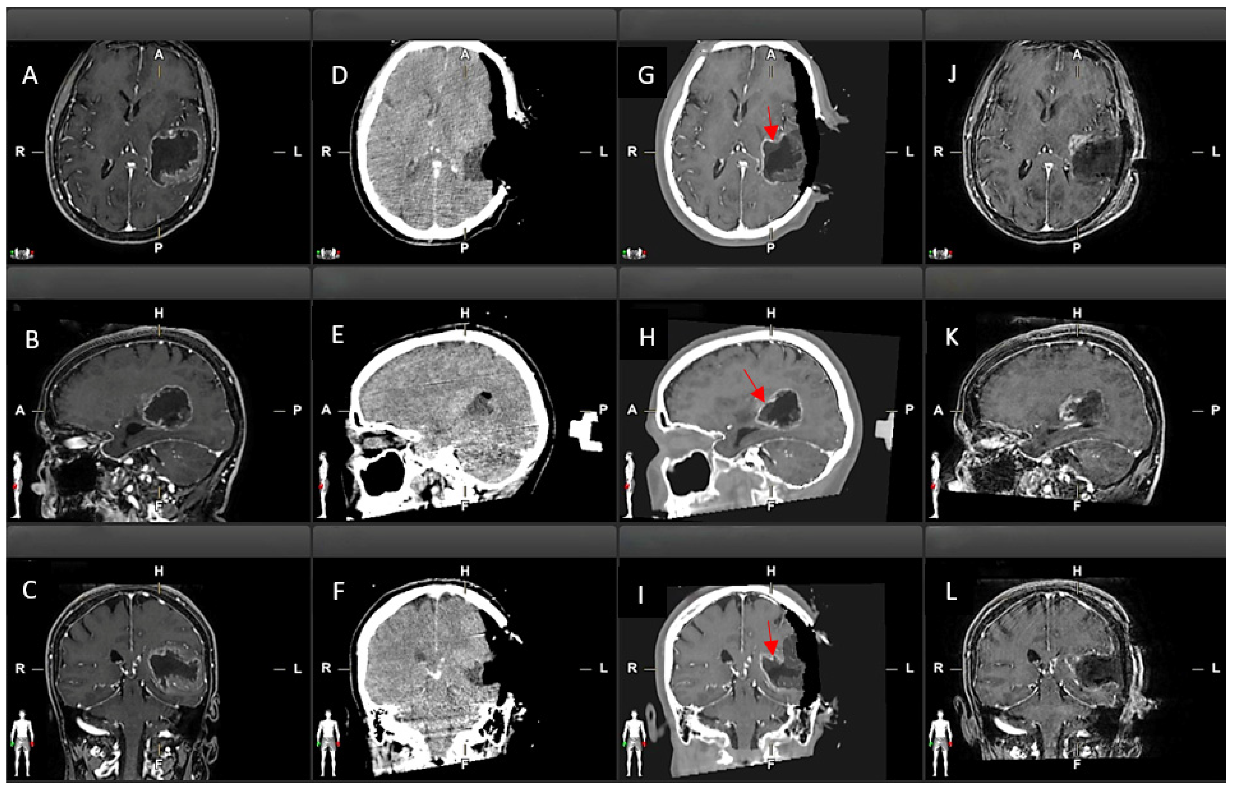 Brainsci 15 00035 g002