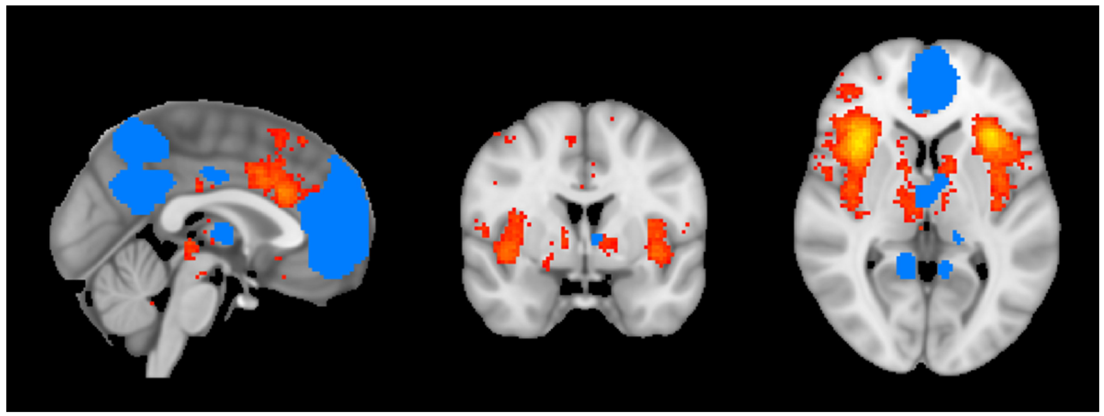 Brainsci 15 00037 g001