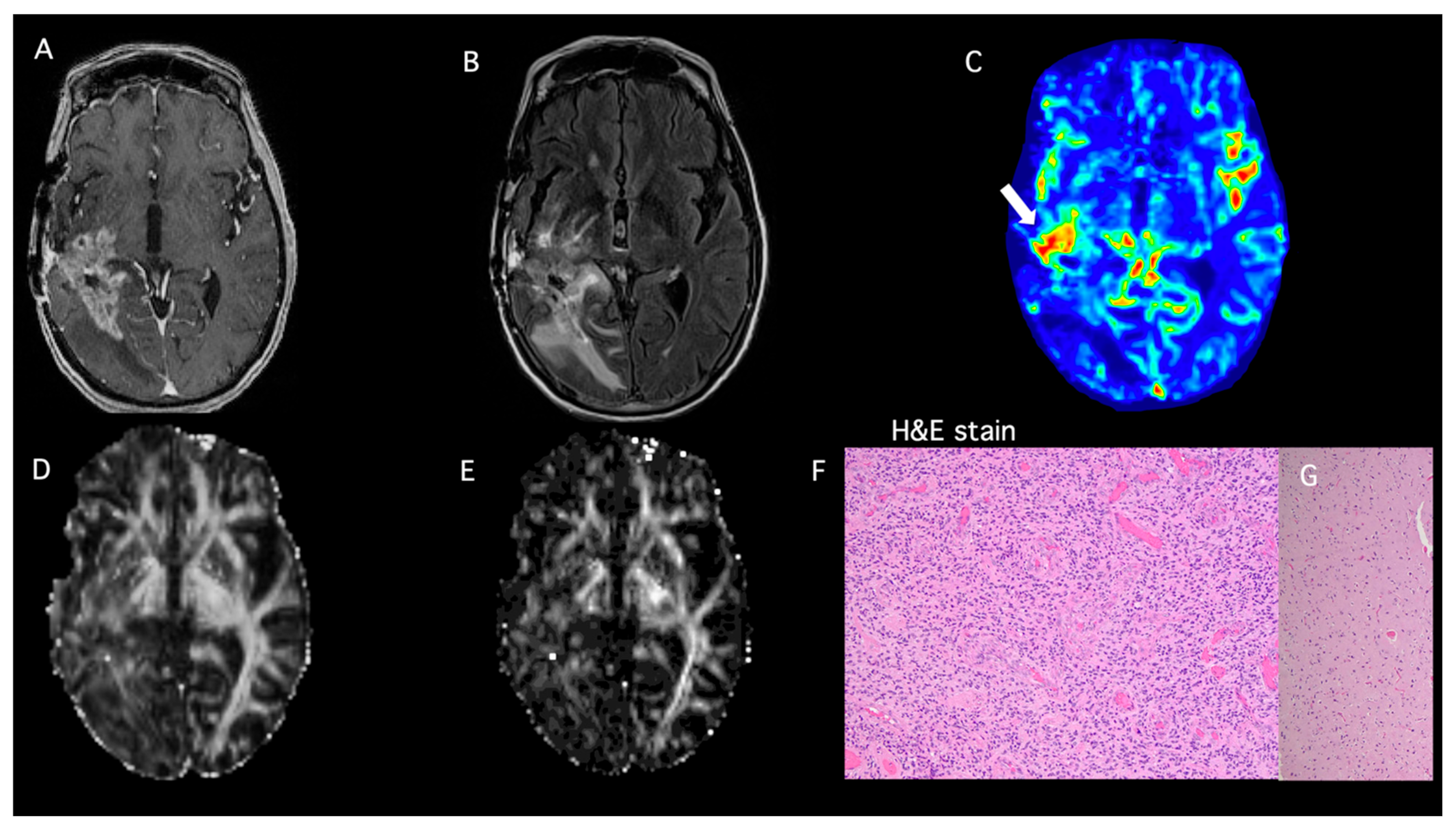 Brainsci 15 00146 g003