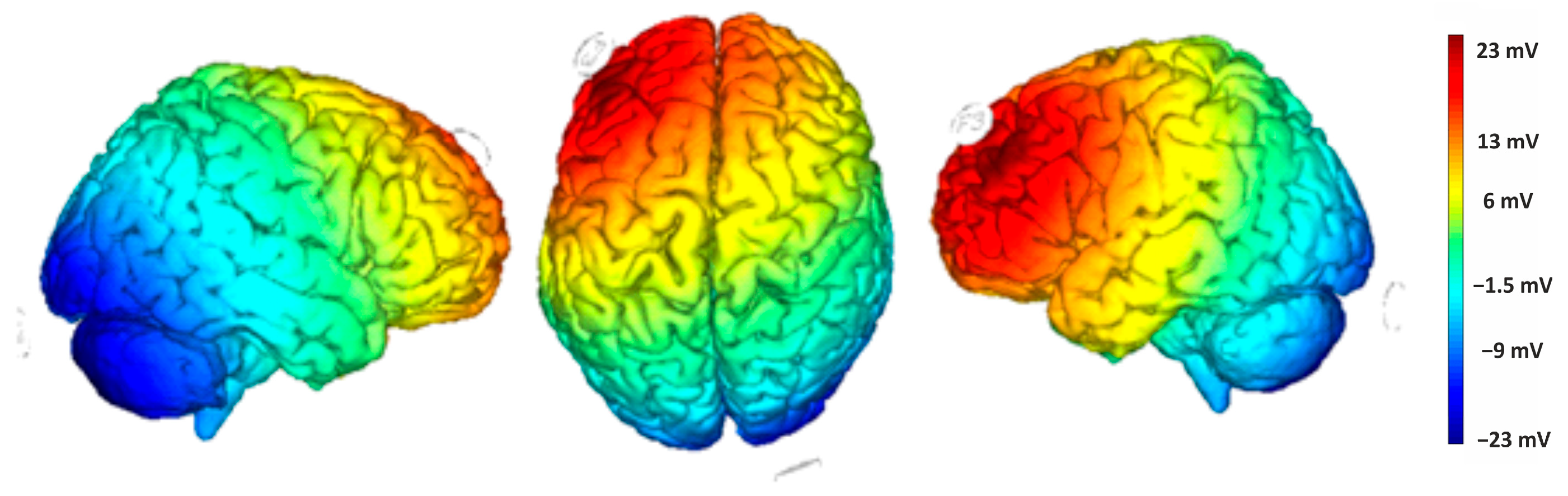 Brainsci 15 00176 g003 Brainsci 15 00176 g003