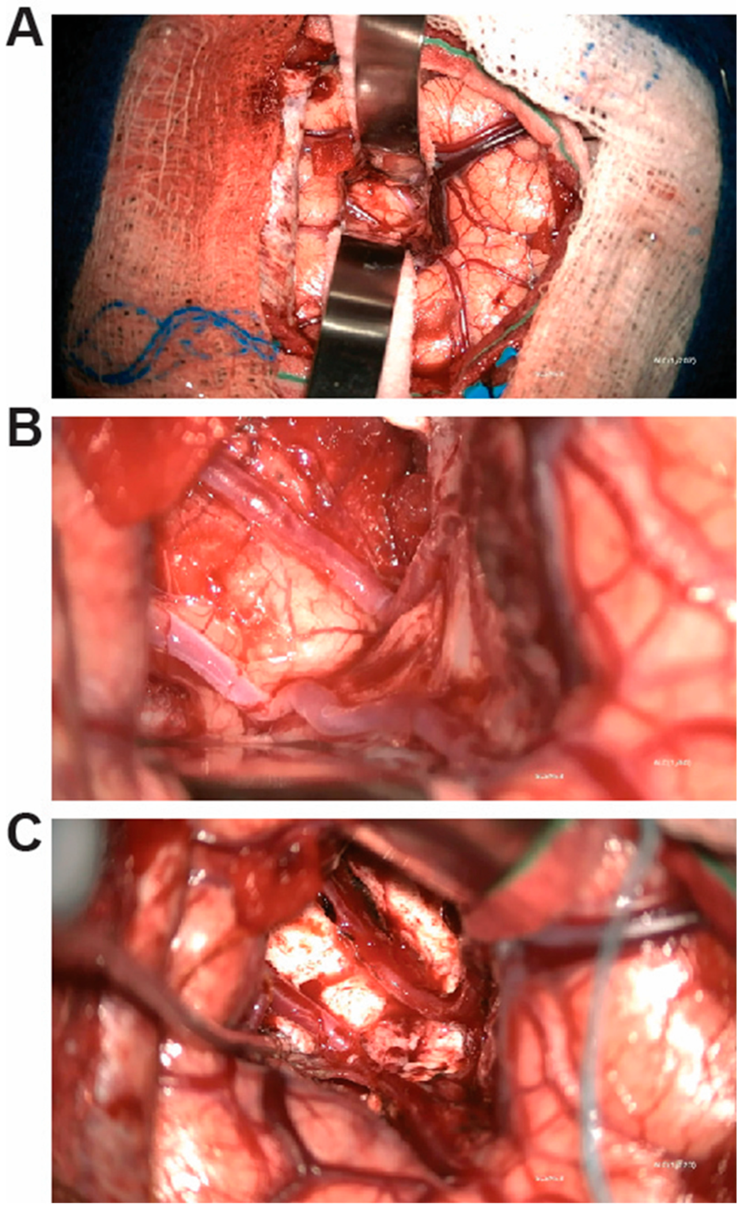 Brainsci 15 00177 g001