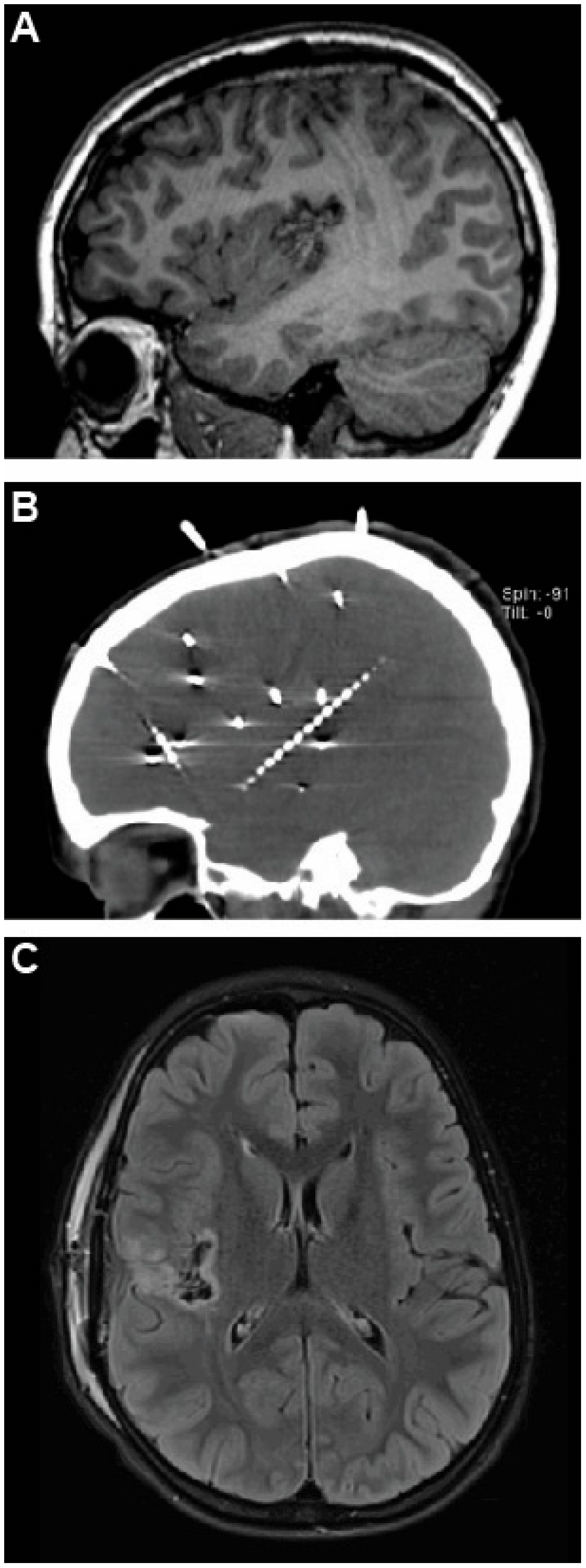 Brainsci 15 00177 g002