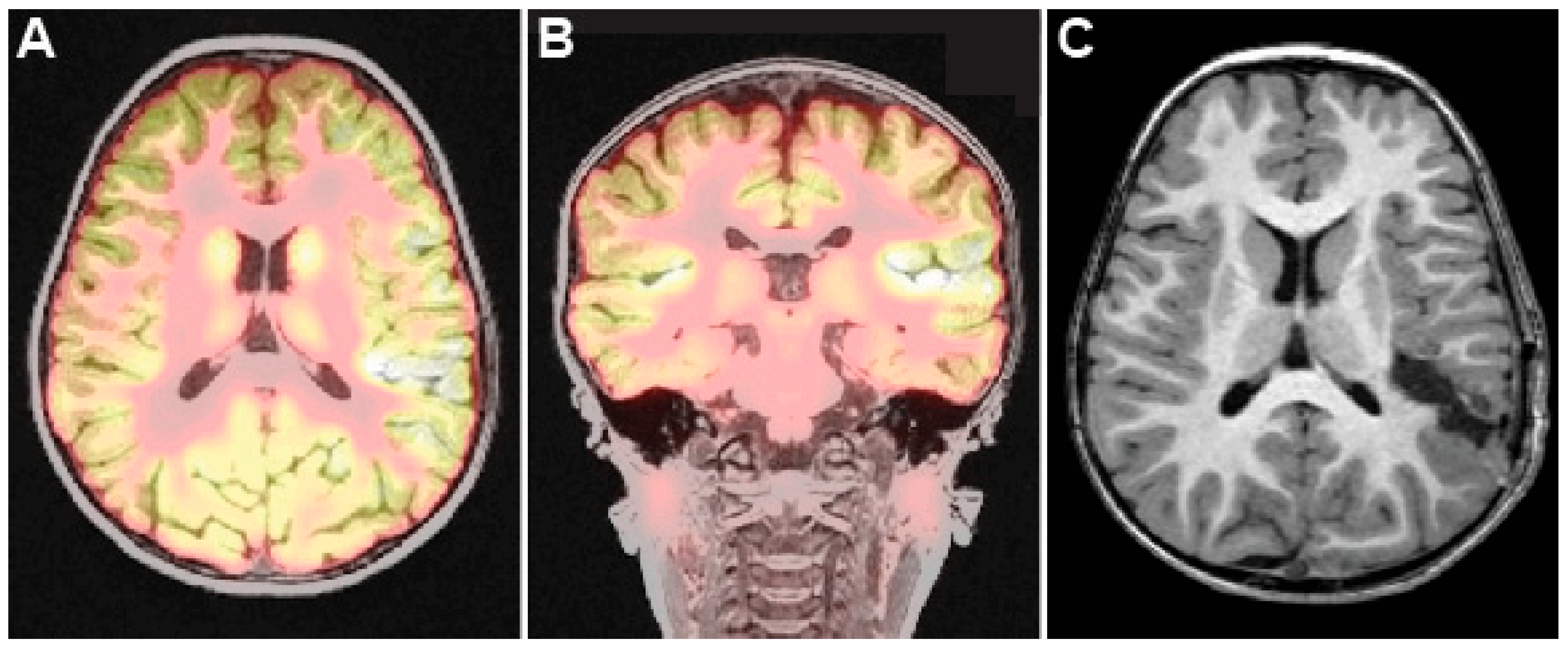 Brainsci 15 00177 g003