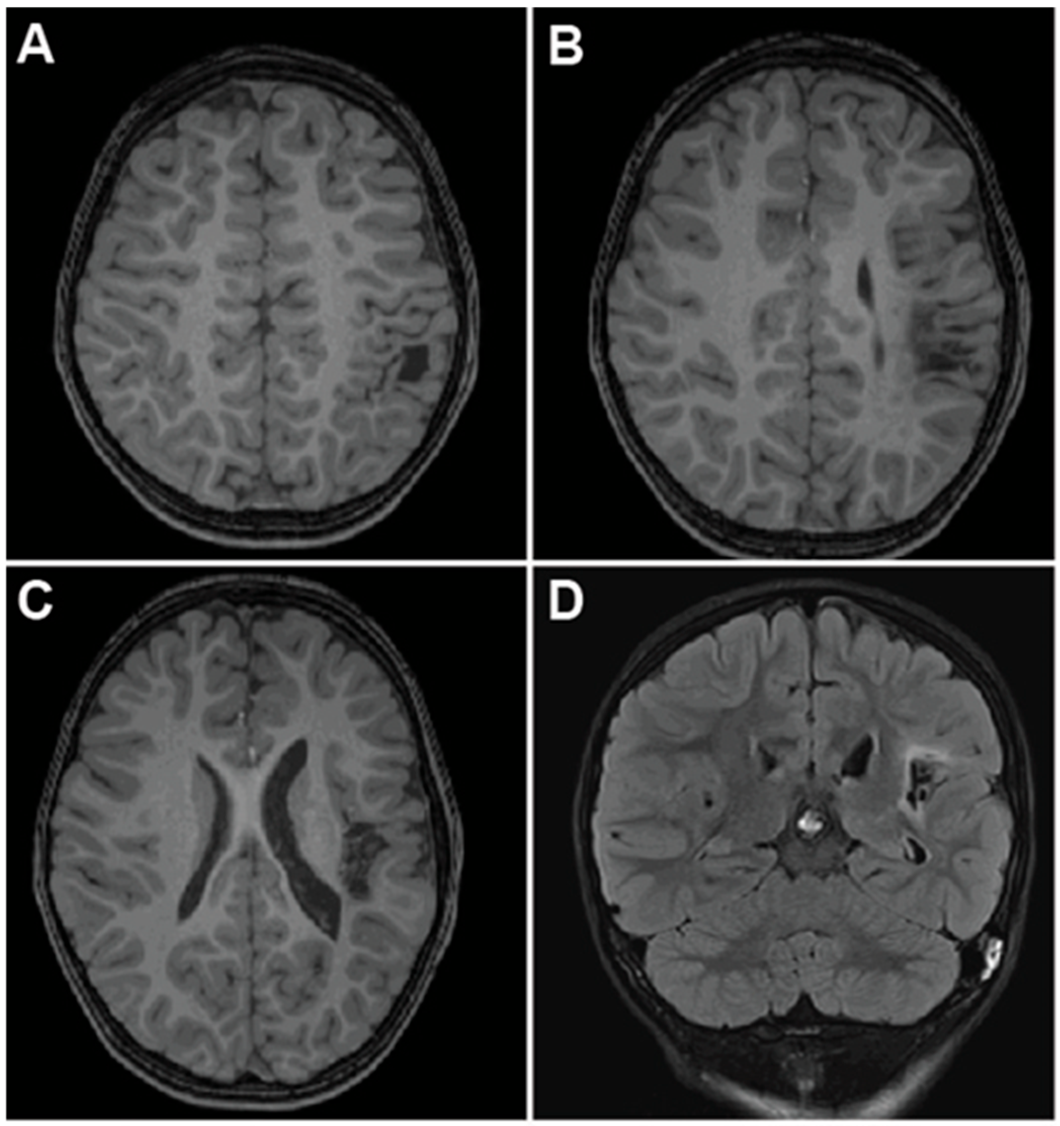 Brainsci 15 00177 g004