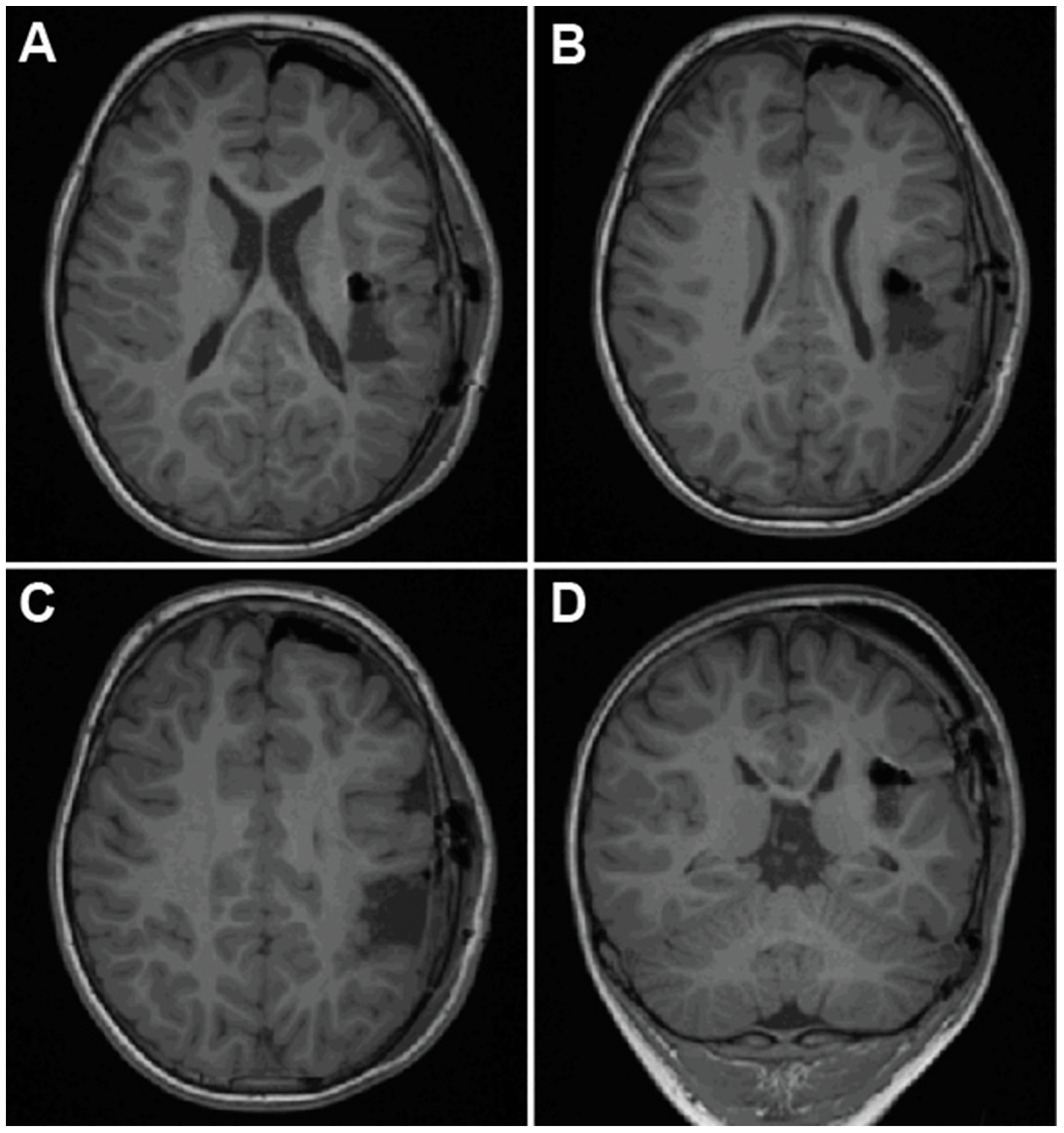 Brainsci 15 00177 g005