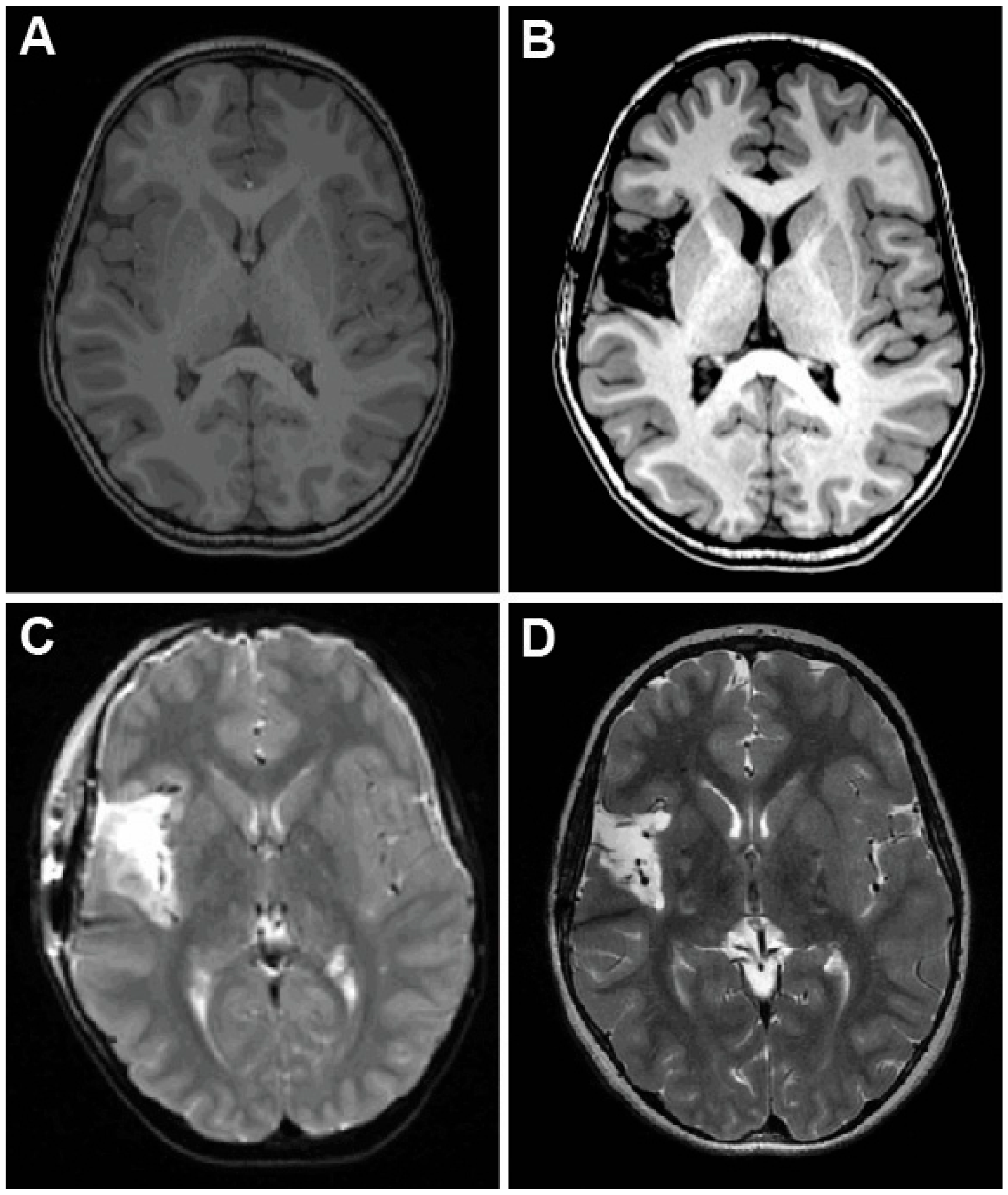 Brainsci 15 00177 g006