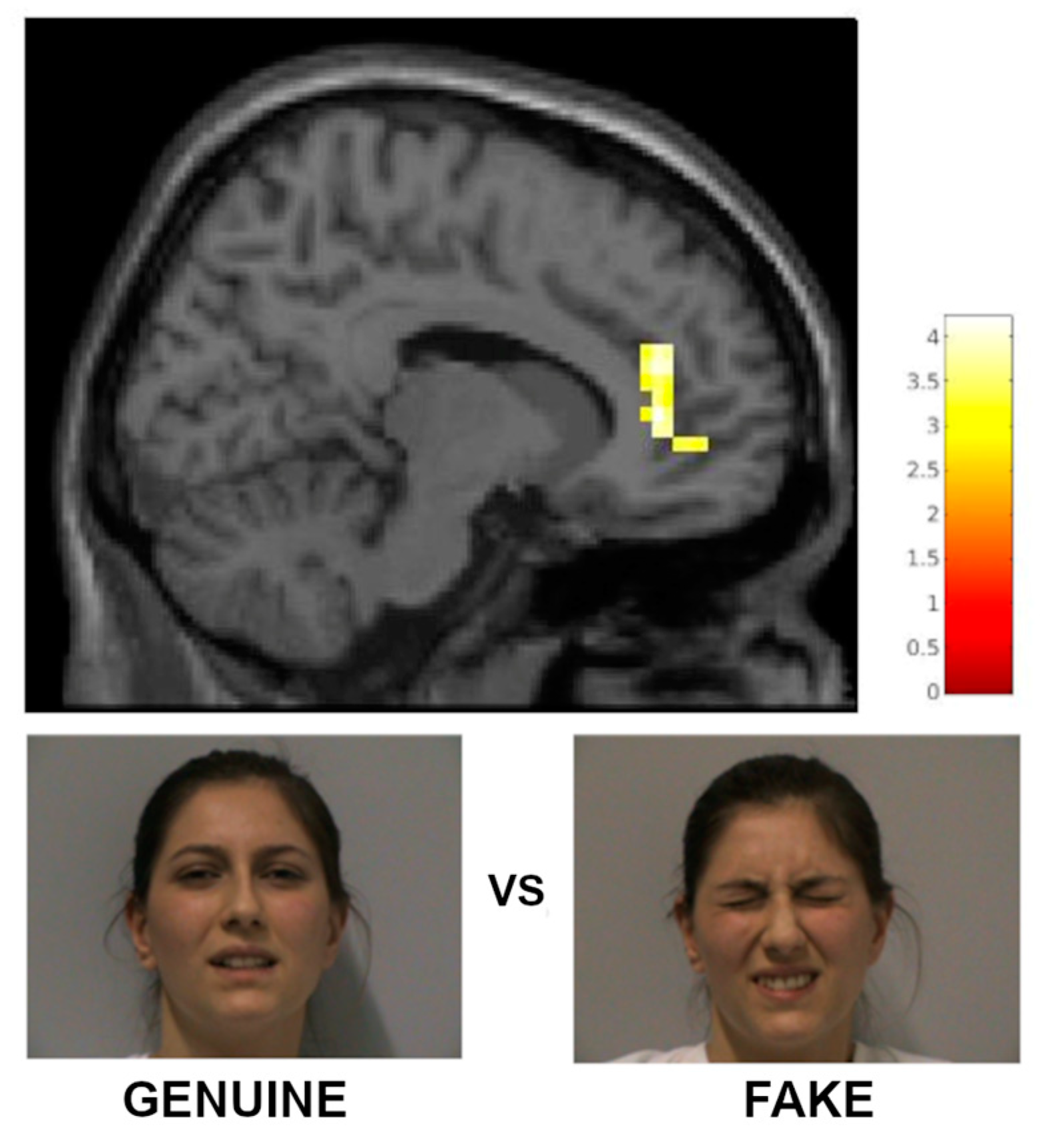 Brainsci 15 00185 g004