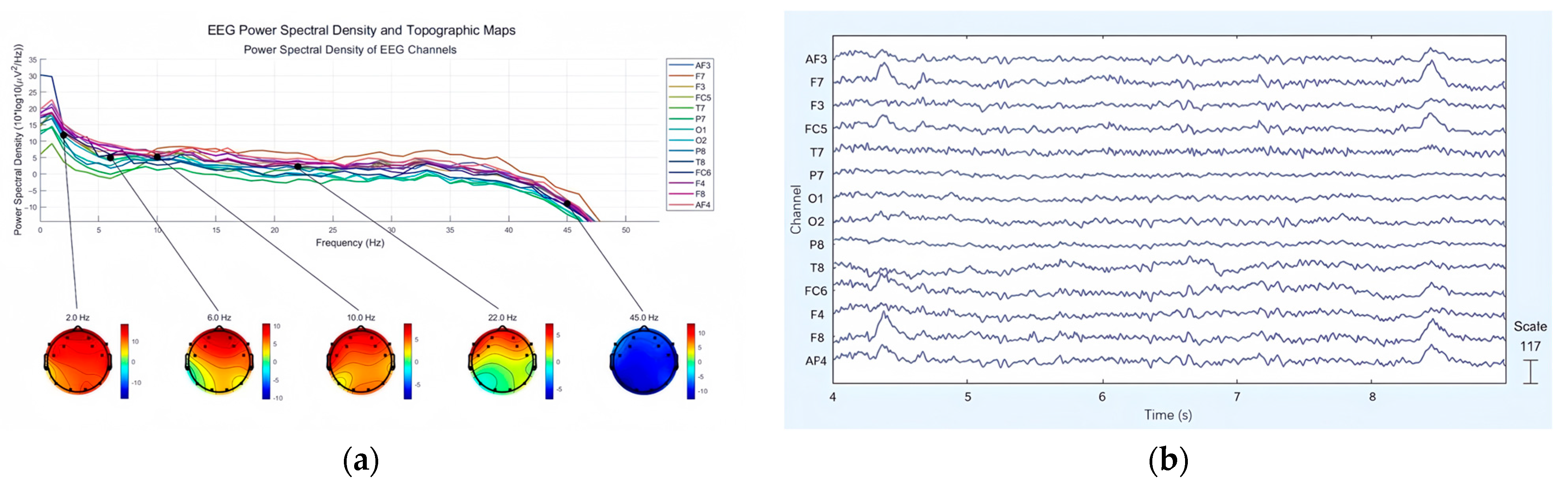 Brainsci 15 00190 g005