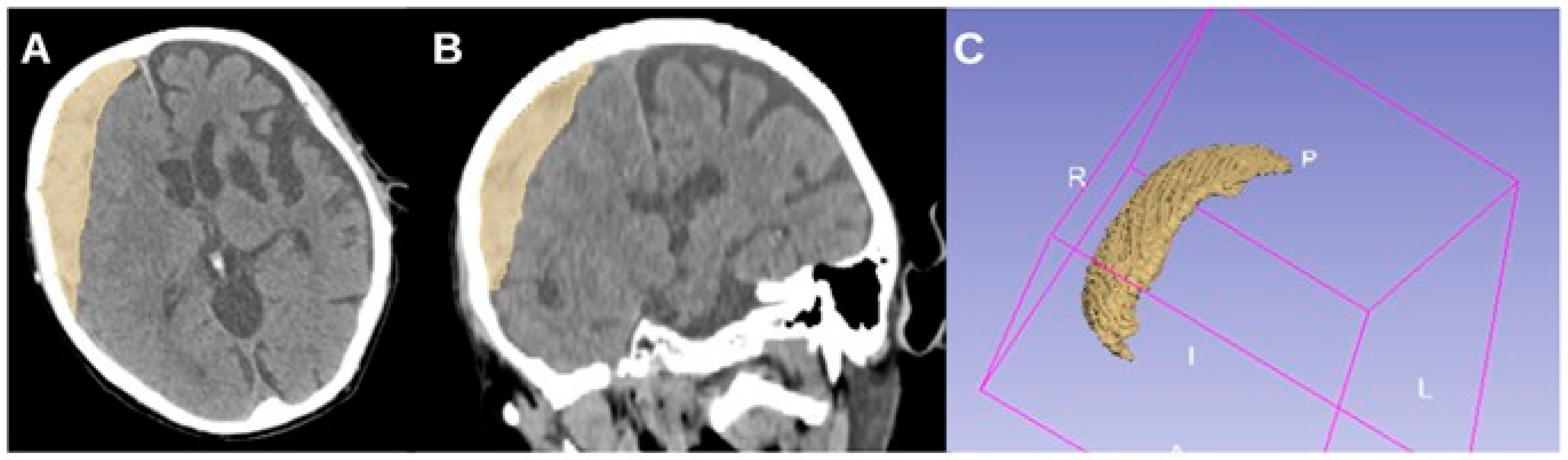 Brainsci 15 00204 g003