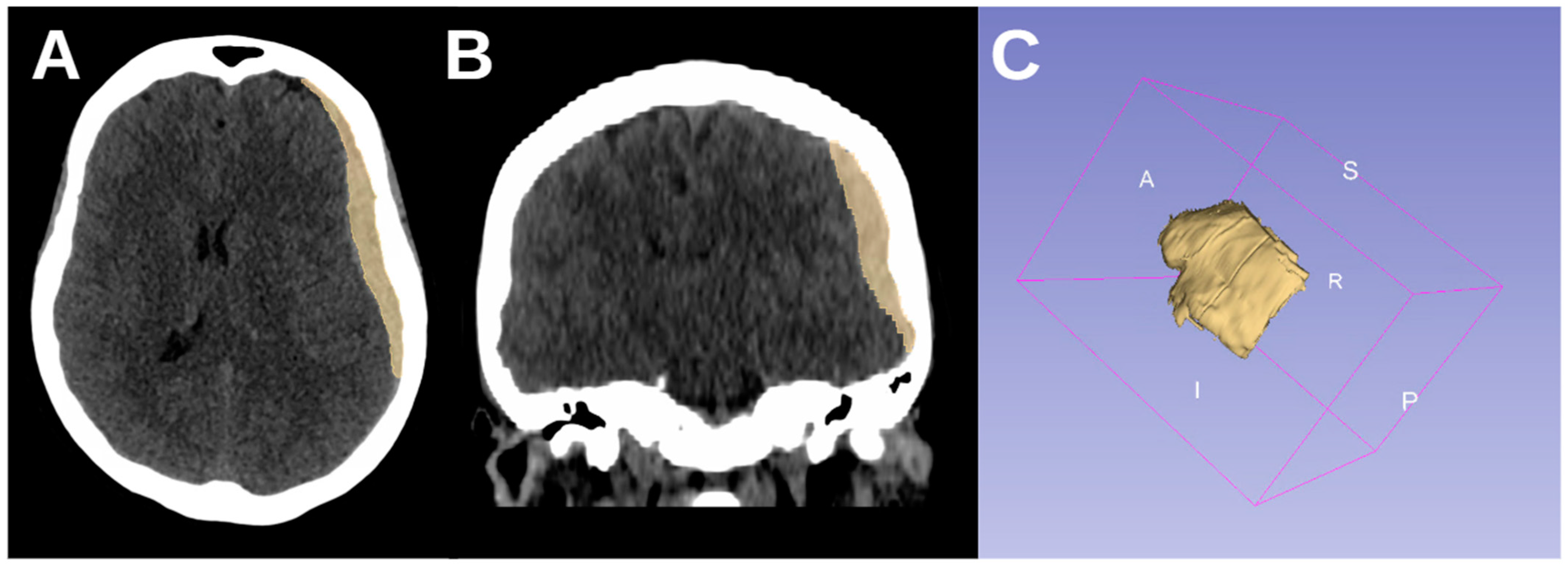 Brainsci 15 00204 g004