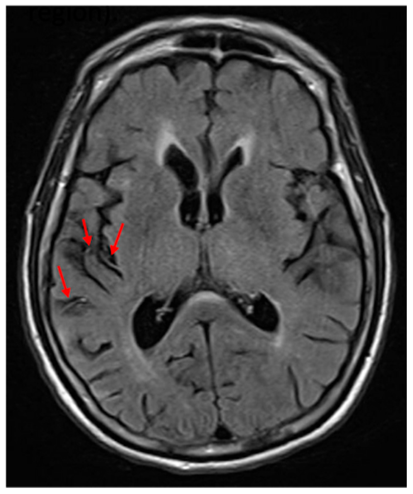 Brainsci 15 00208 g001