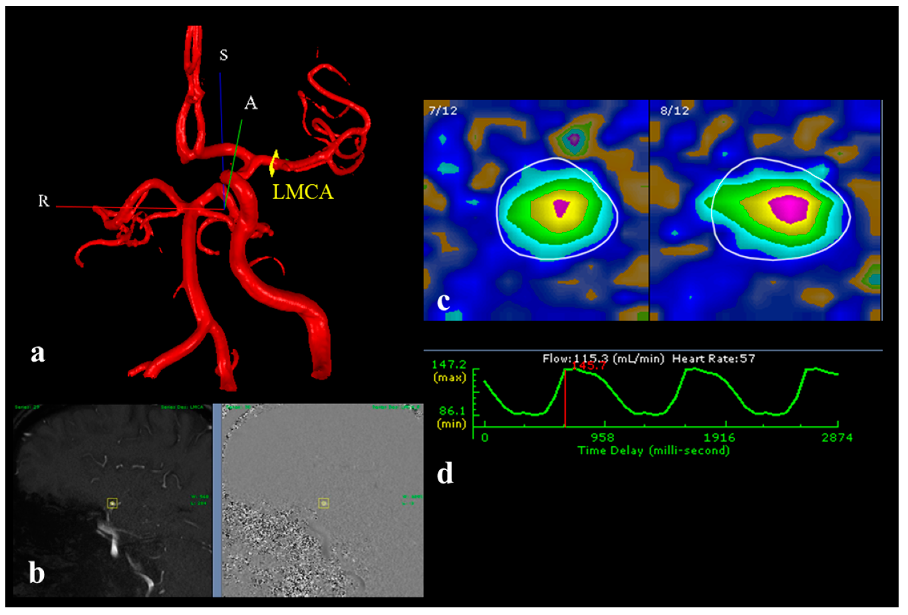 Brainsci 15 00211 g001