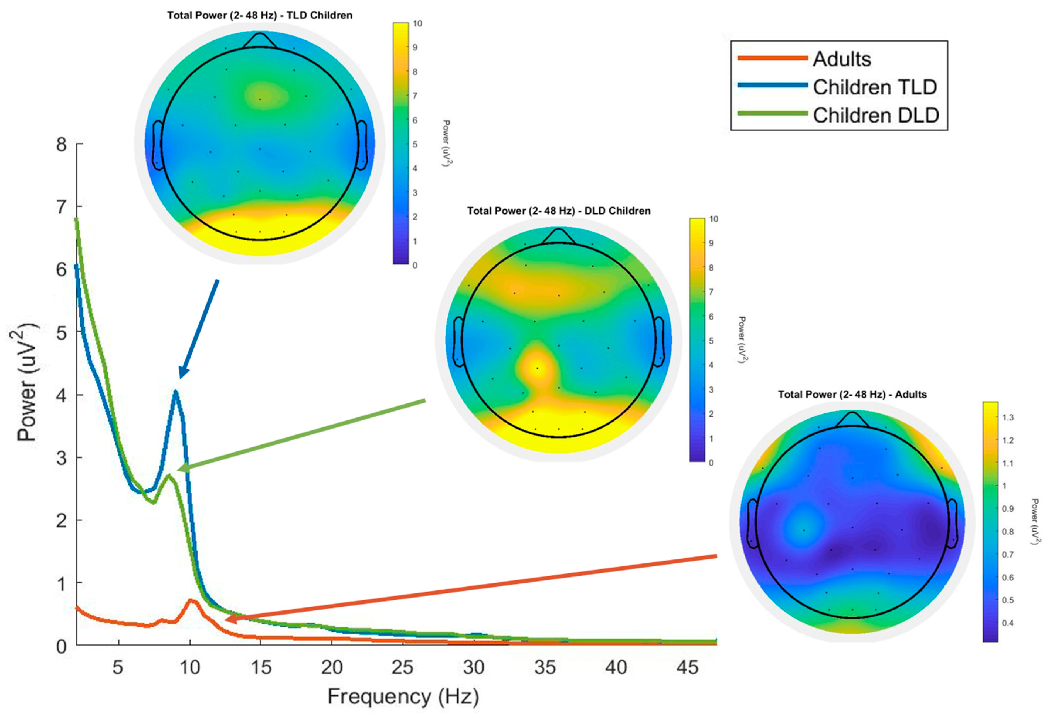Brainsci 15 00219 g001
