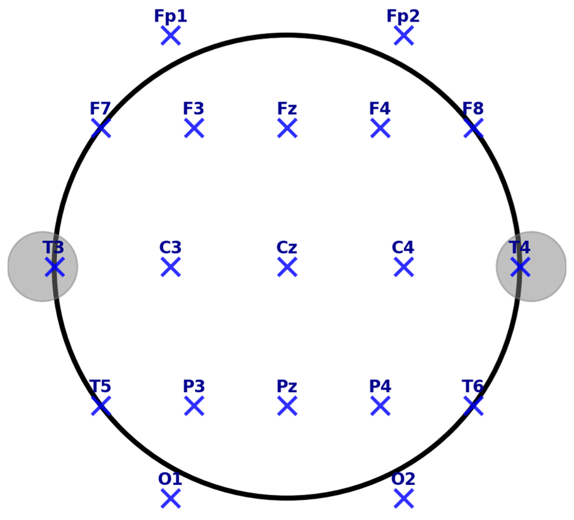 Brainsci 15 00220 g004