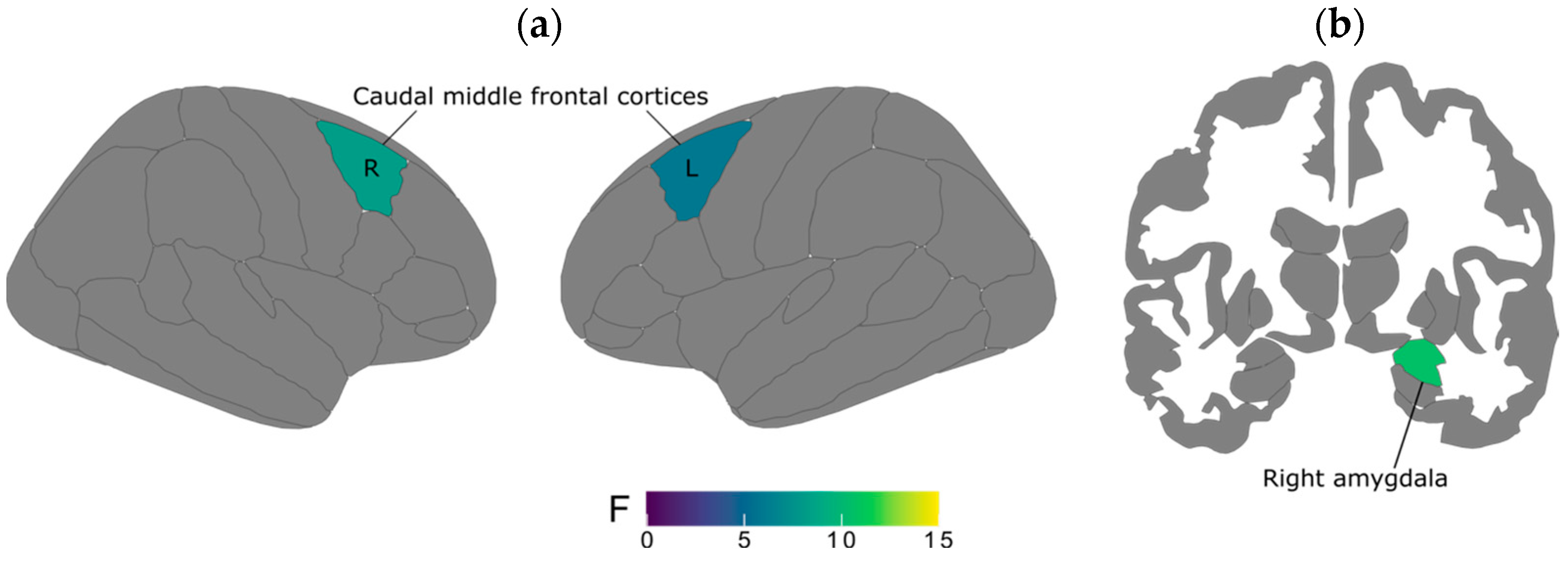Brainsci 15 00224 g001 Brainsci 15 00224 g001