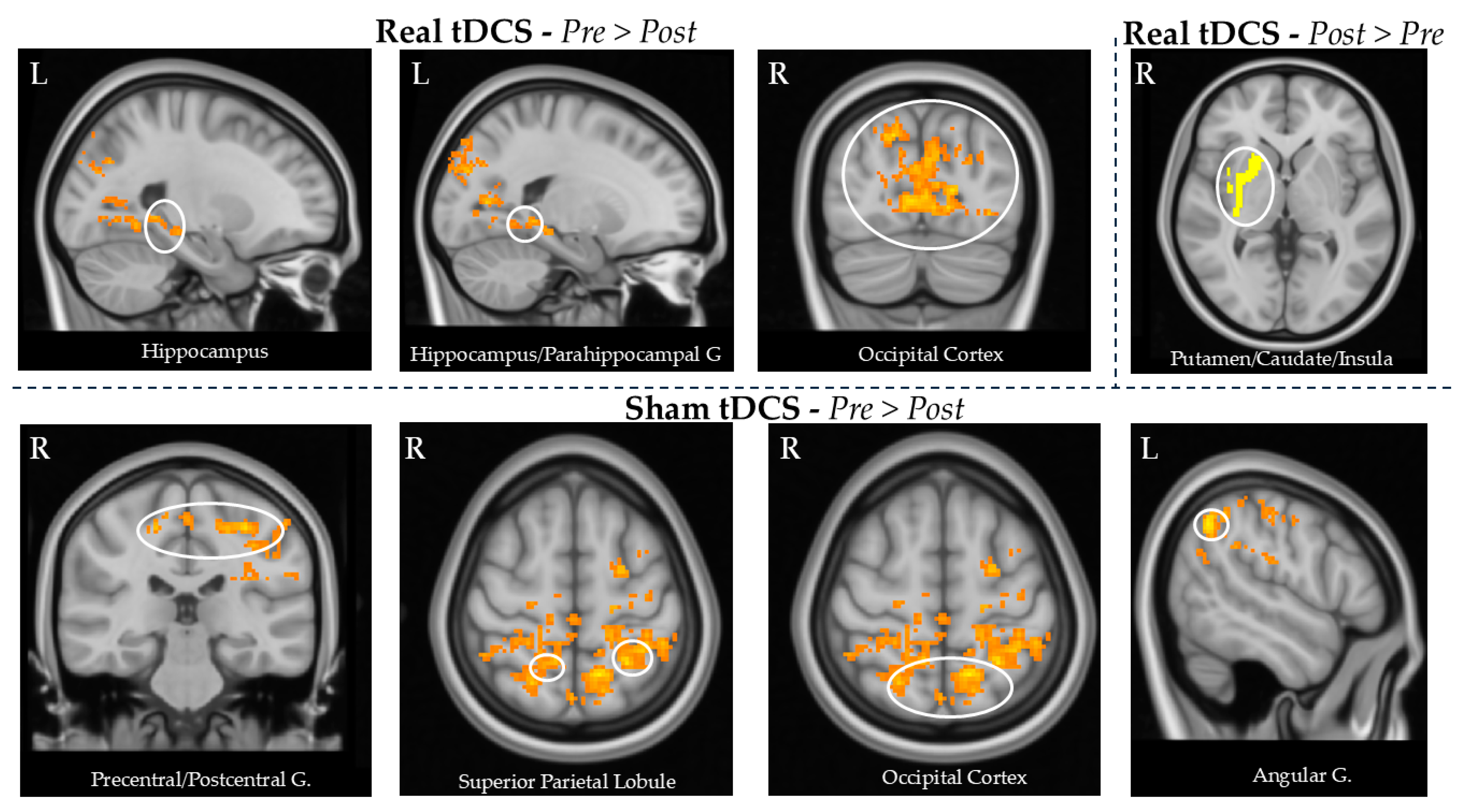 Brainsci 15 00261 g003