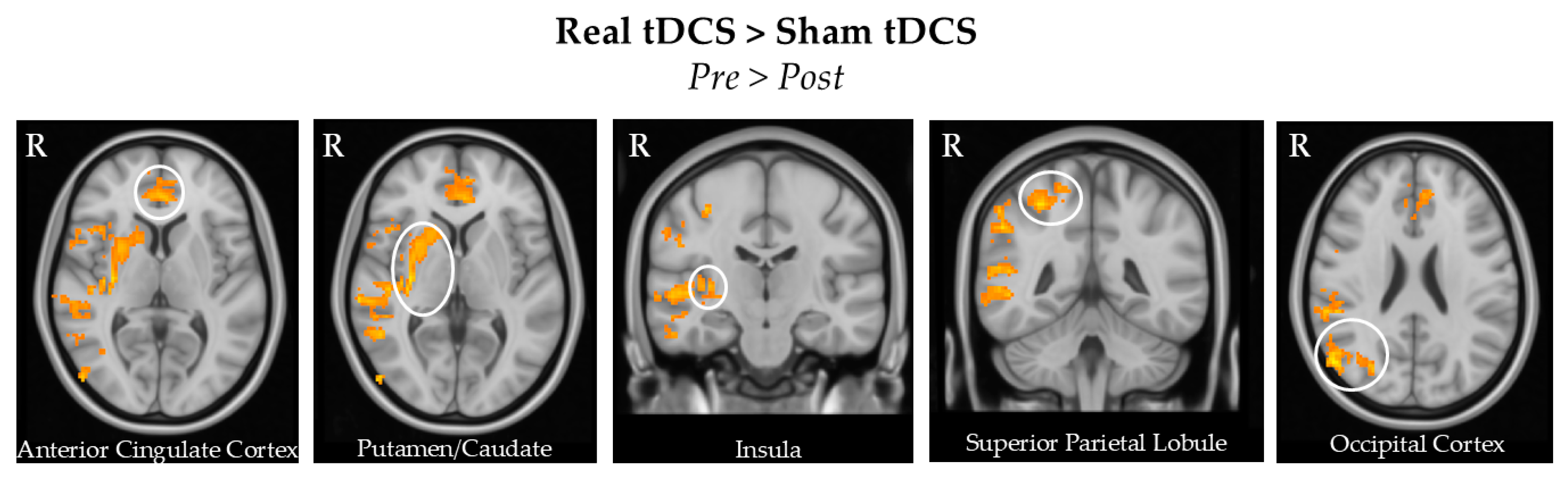 Brainsci 15 00261 g004