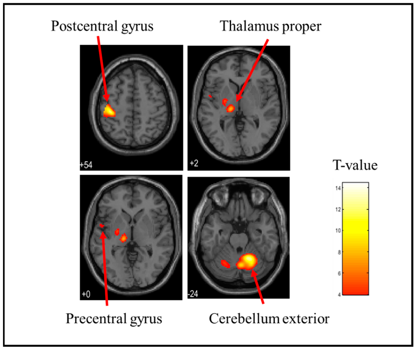 Brainsci 15 00264 g004