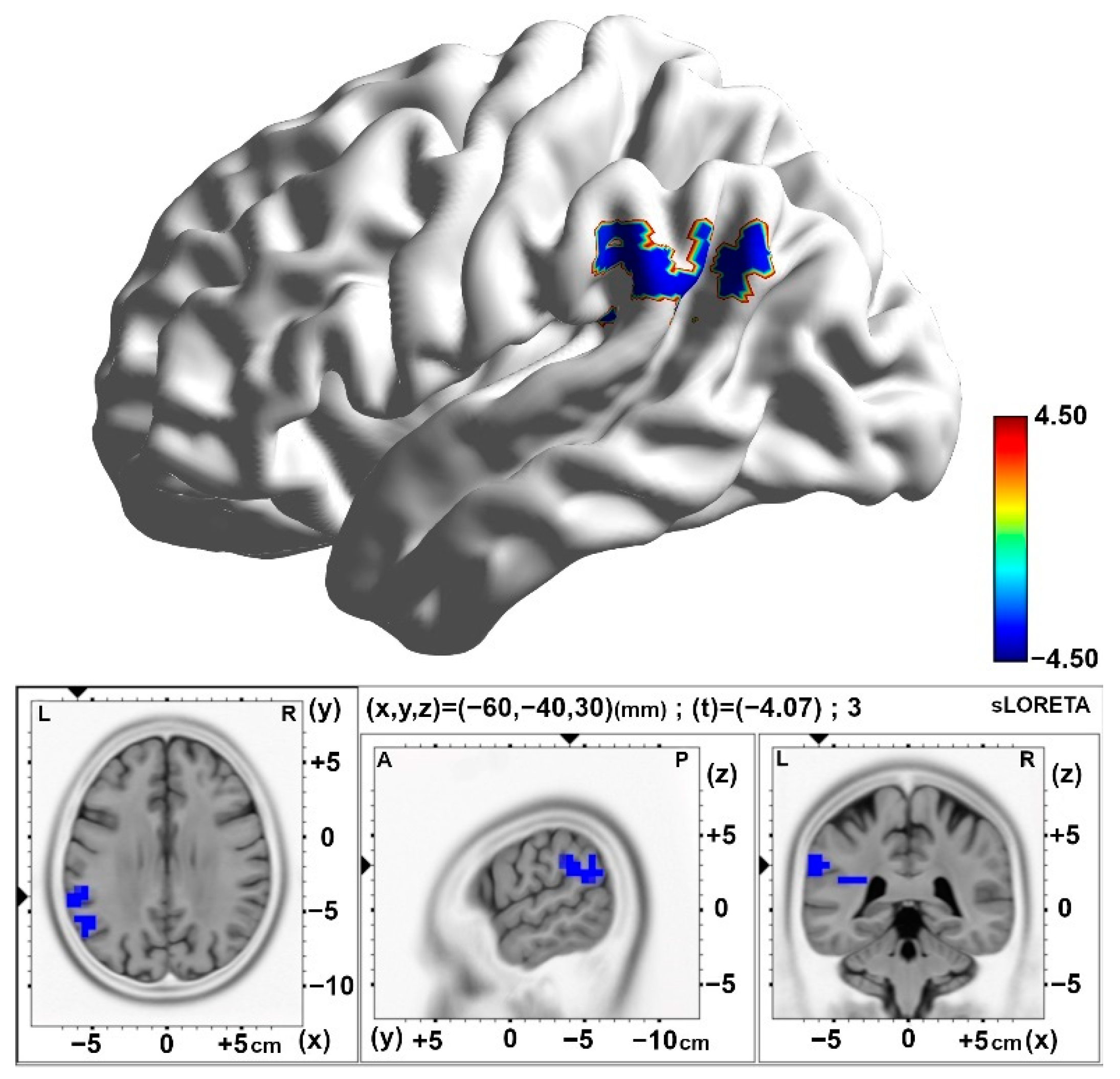 Brainsci 15 00270 g005