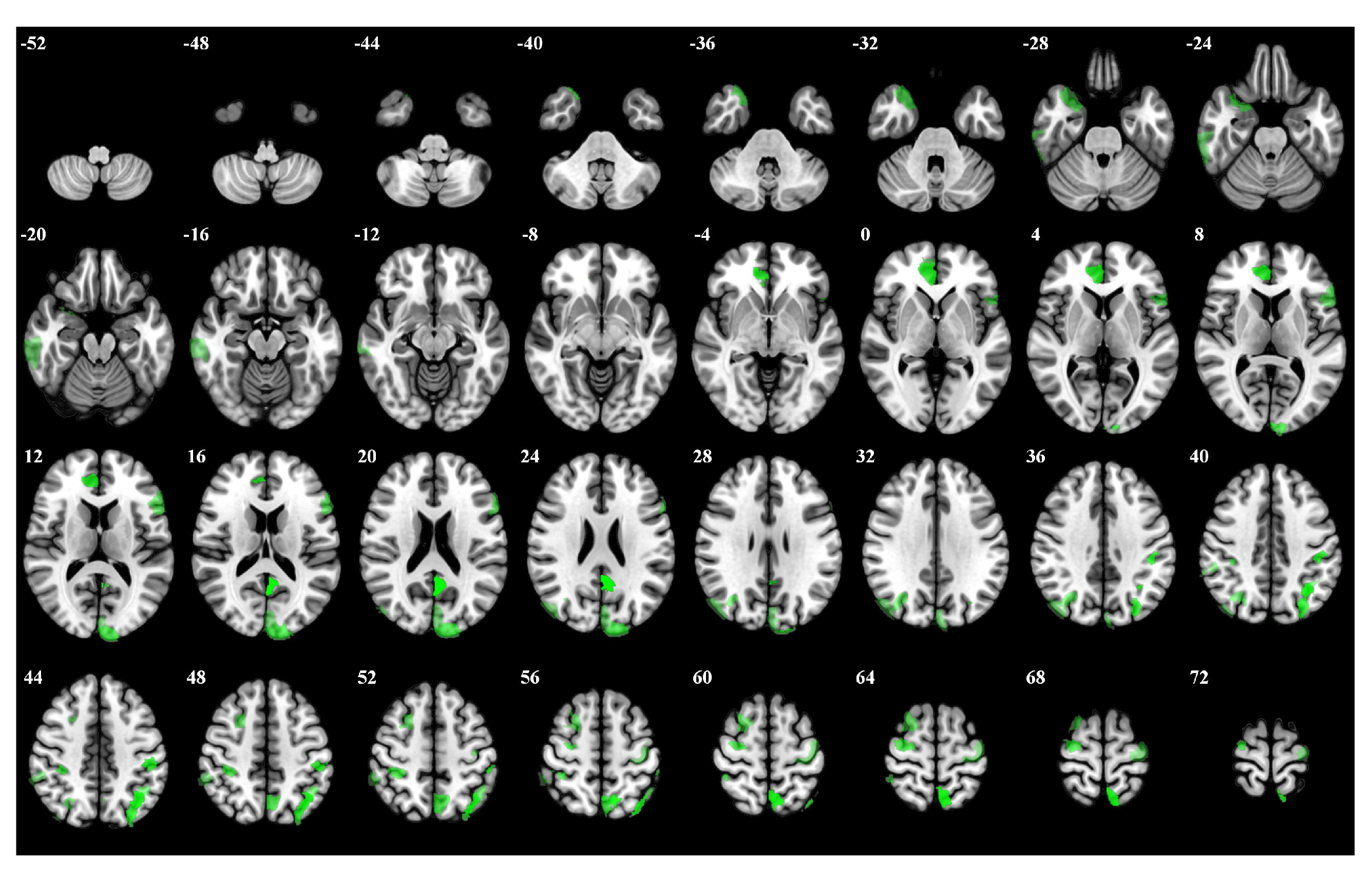 Brainsci 15 00277 g006