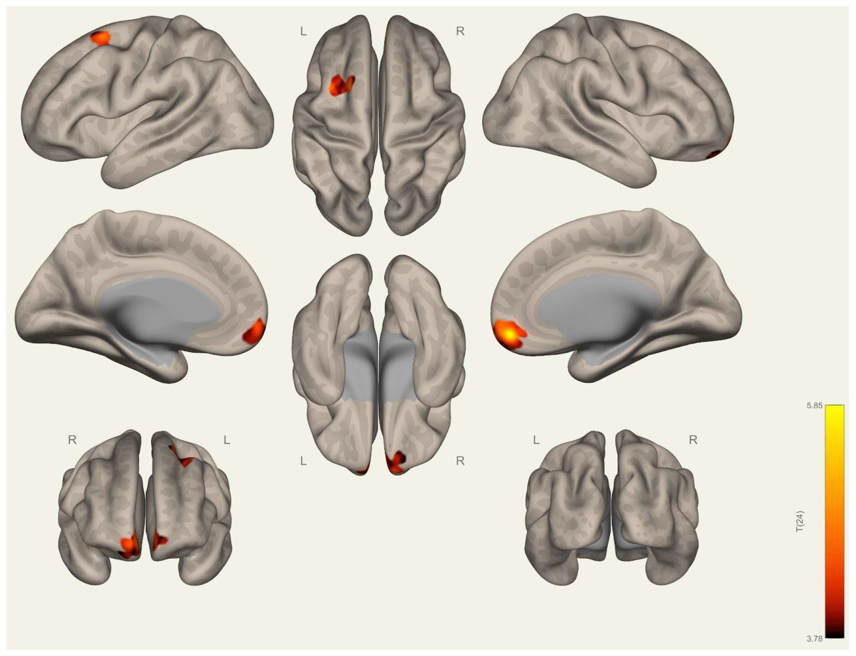 Brainsci 15 00285 g004