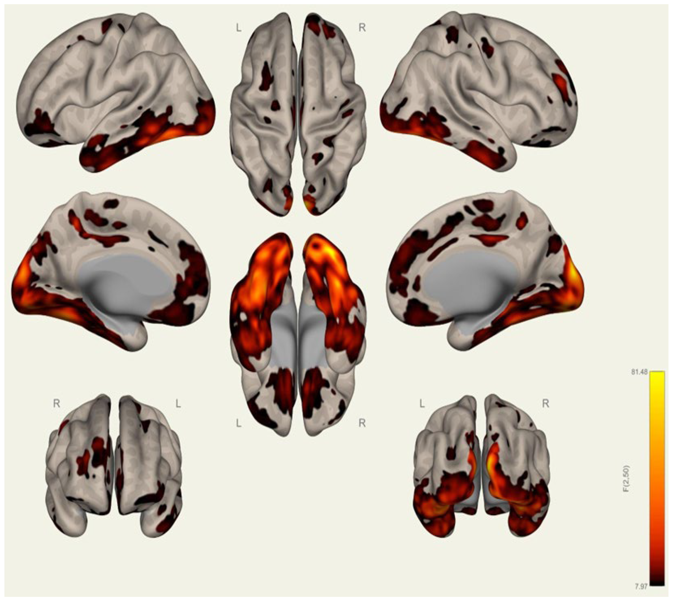 Brainsci 15 00285 g0a11
