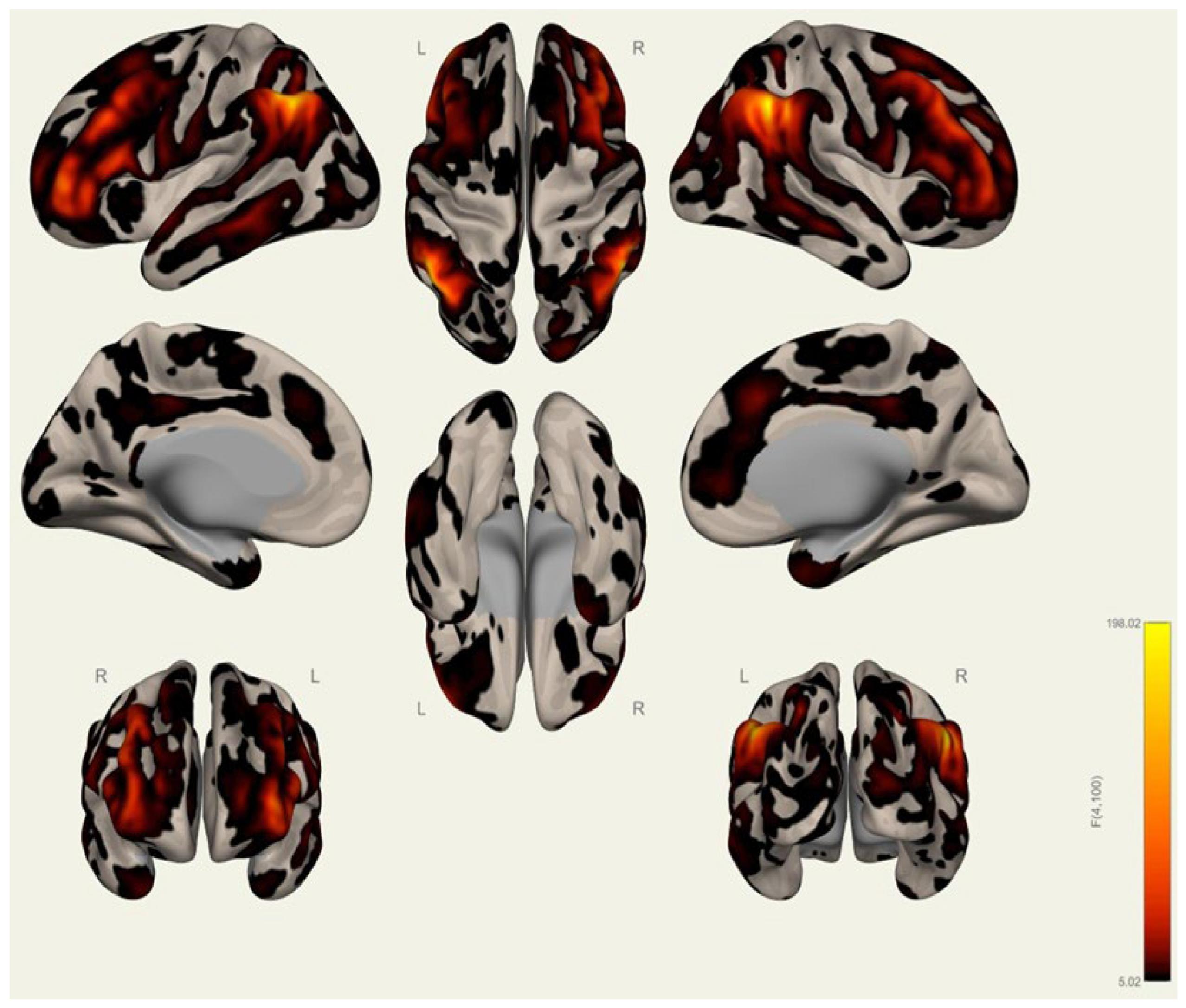 Brainsci 15 00285 g0a9