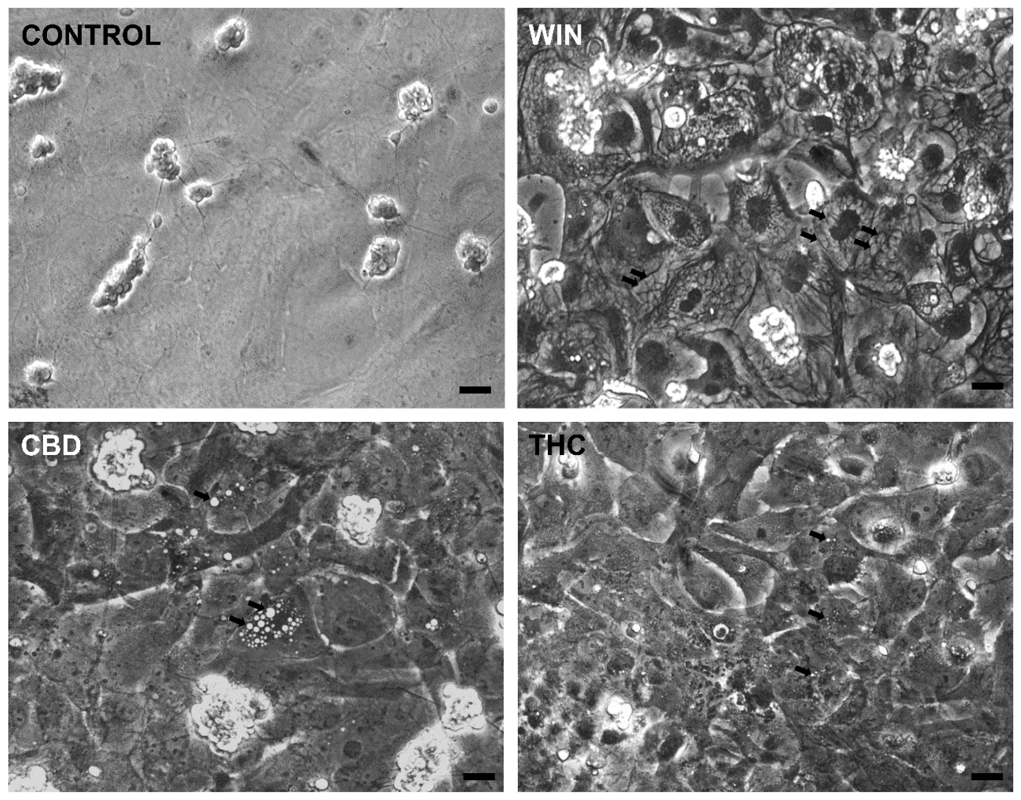Brainsci 15 00291 g003 Brainsci 15 00291 g003