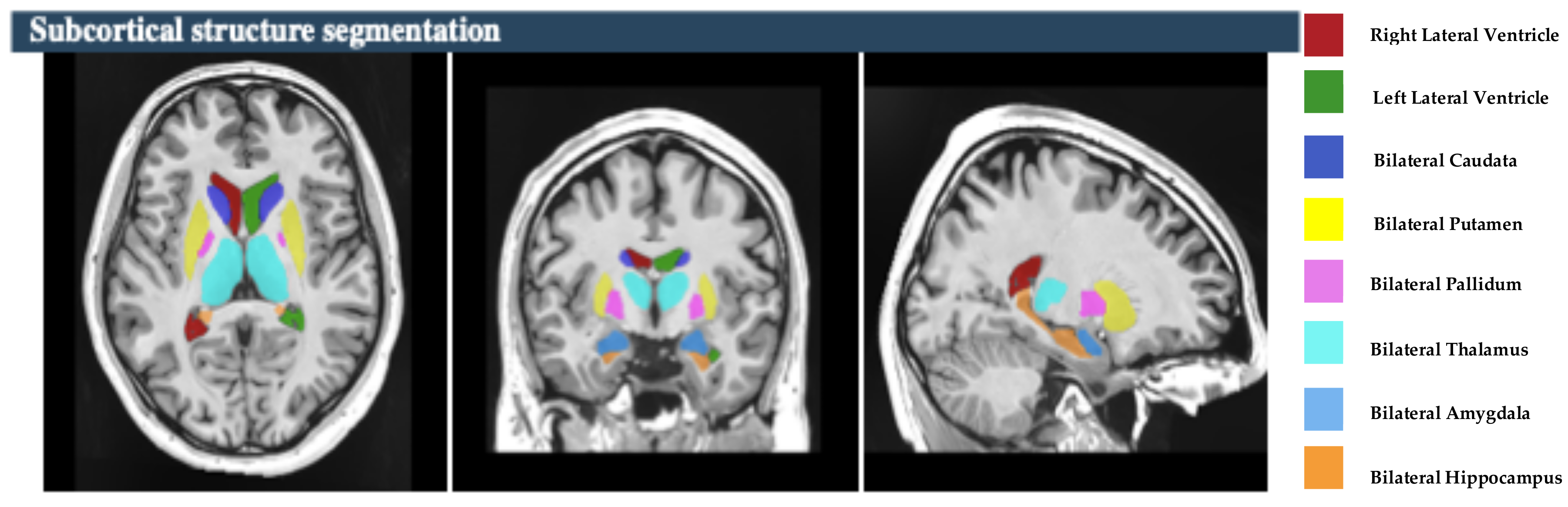 Brainsci 15 00295 g002