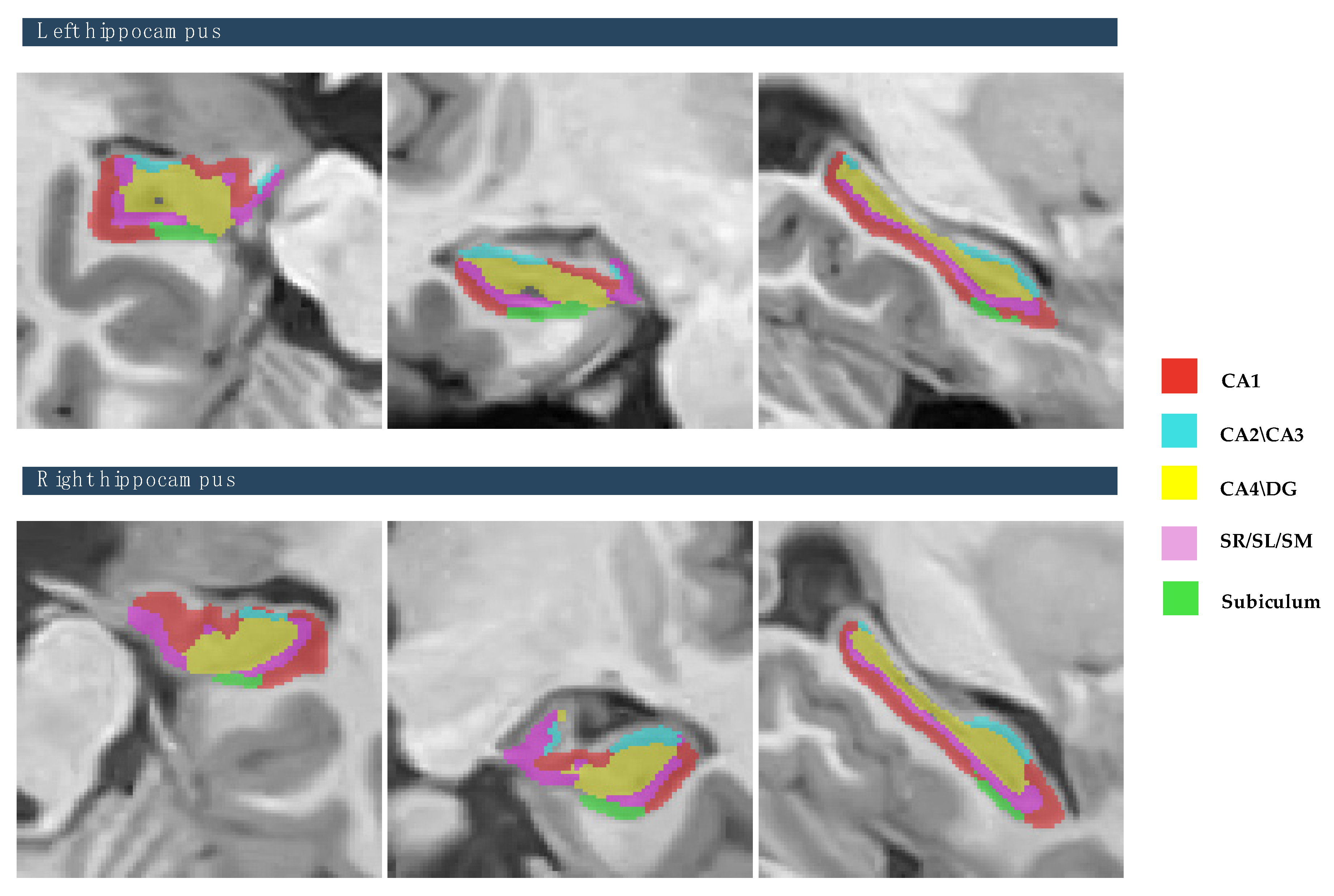 Brainsci 15 00295 g003