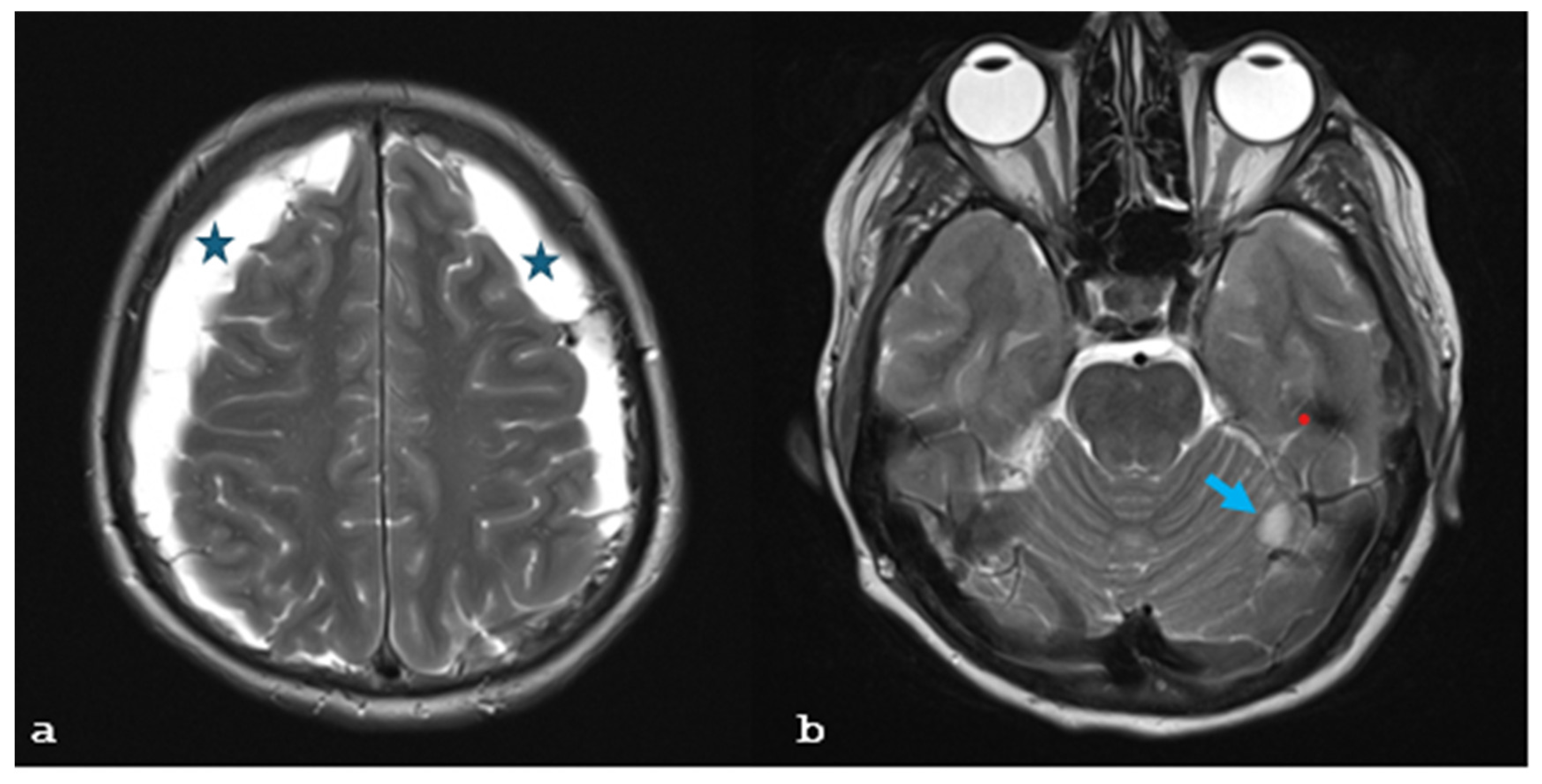 Brainsci 15 00296 g001a Brainsci 15 00296 g001a