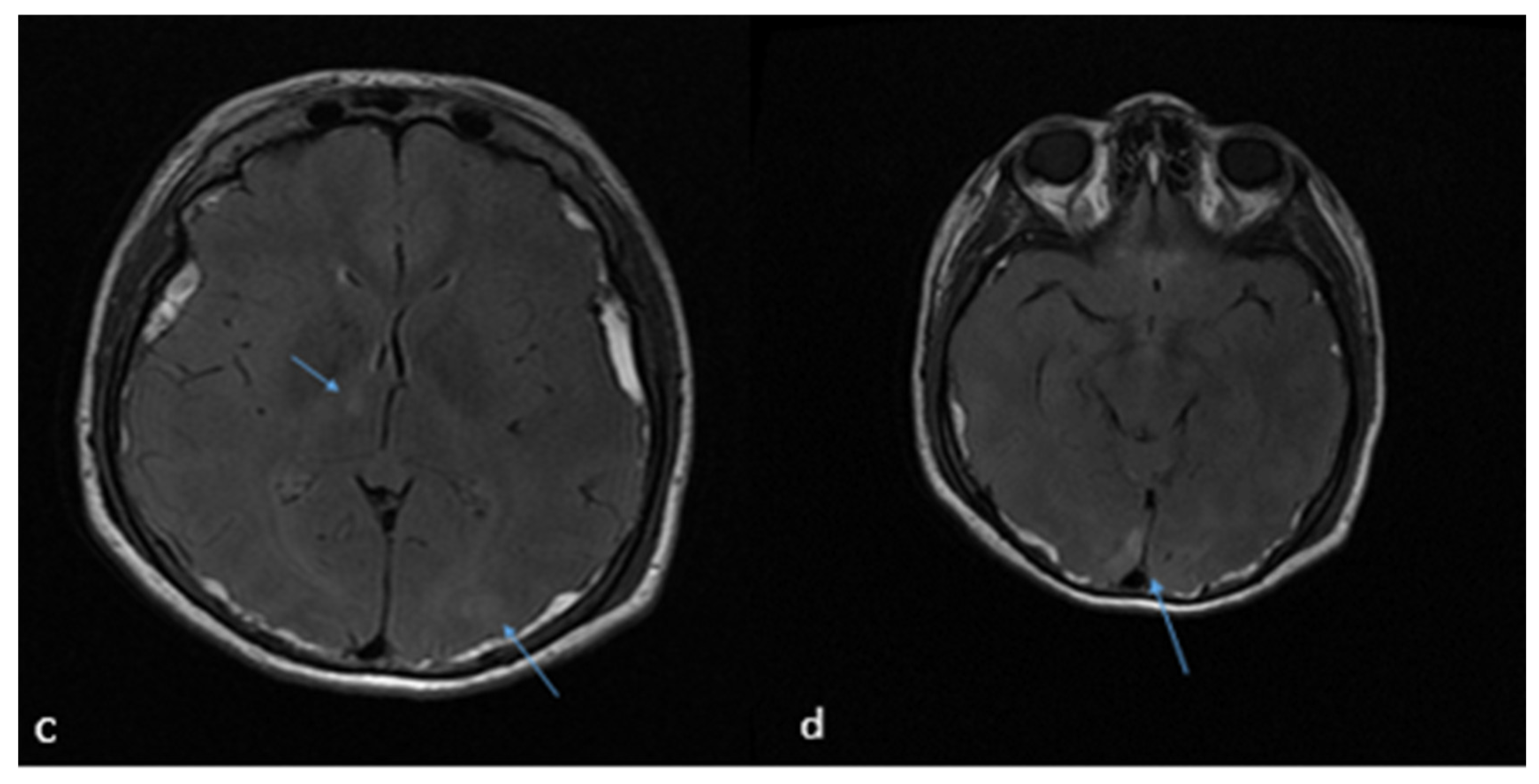 Brainsci 15 00296 g001b Brainsci 15 00296 g001b