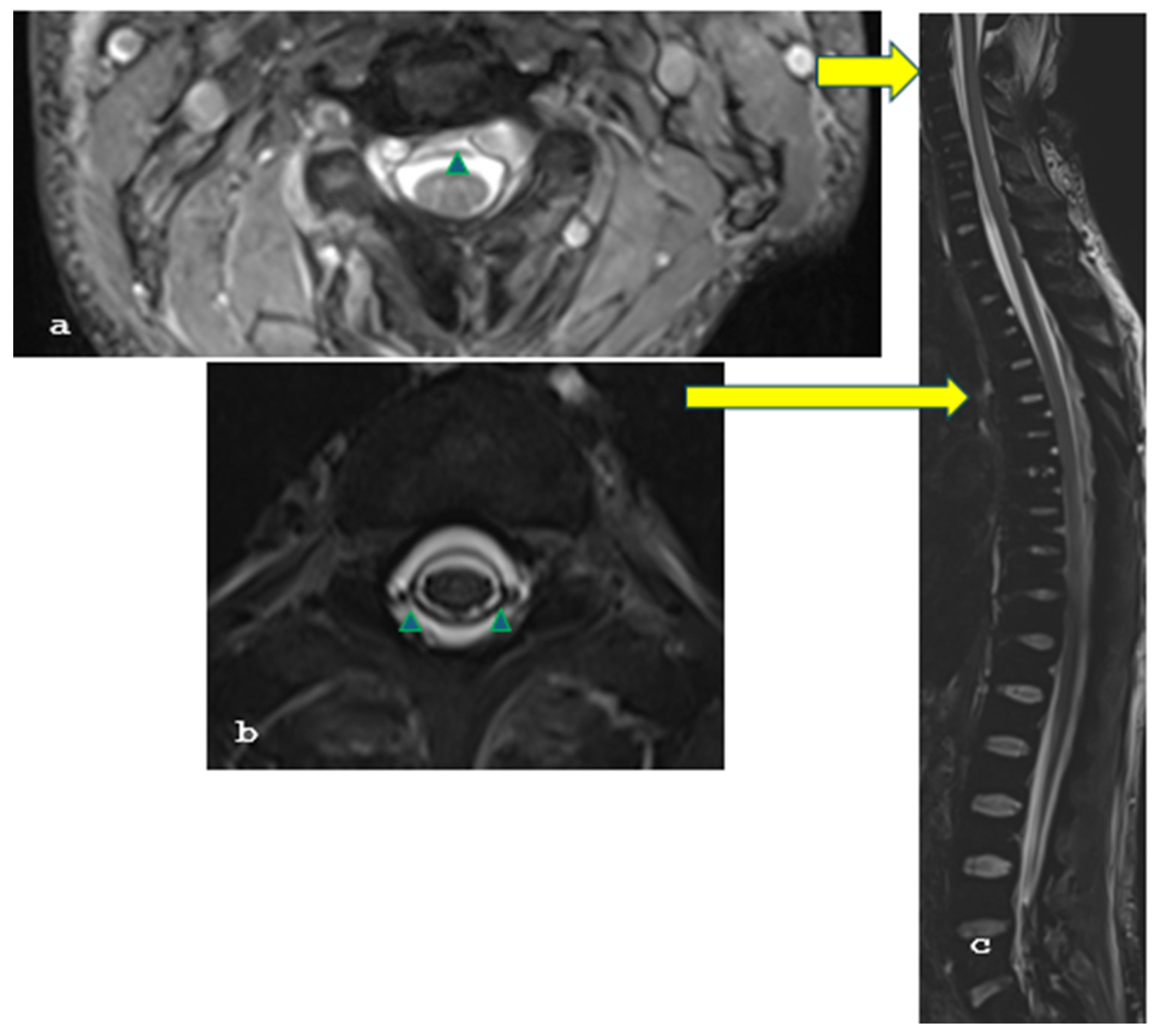 Brainsci 15 00296 g002 Brainsci 15 00296 g002