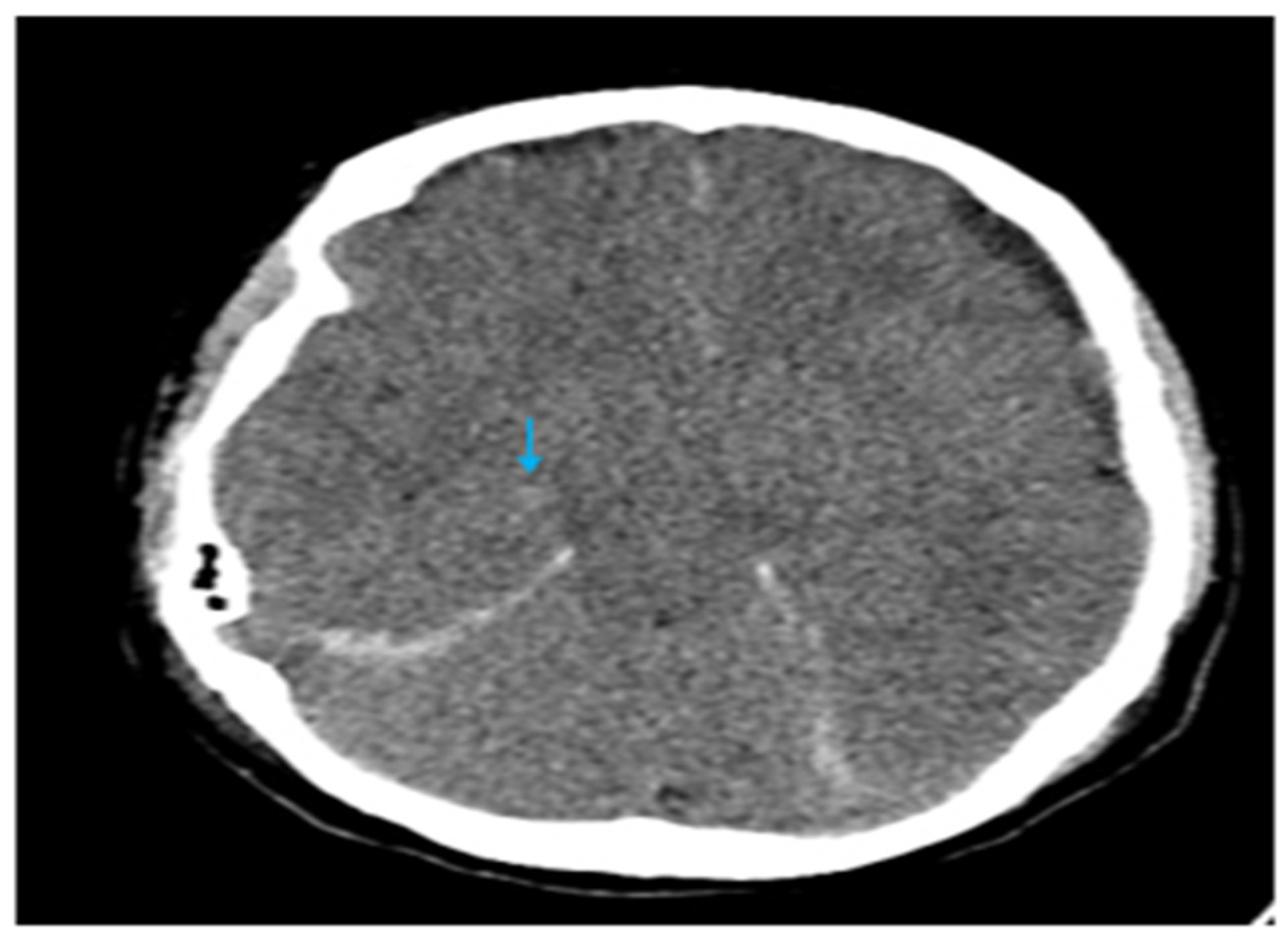 Brainsci 15 00296 g003 Brainsci 15 00296 g003
