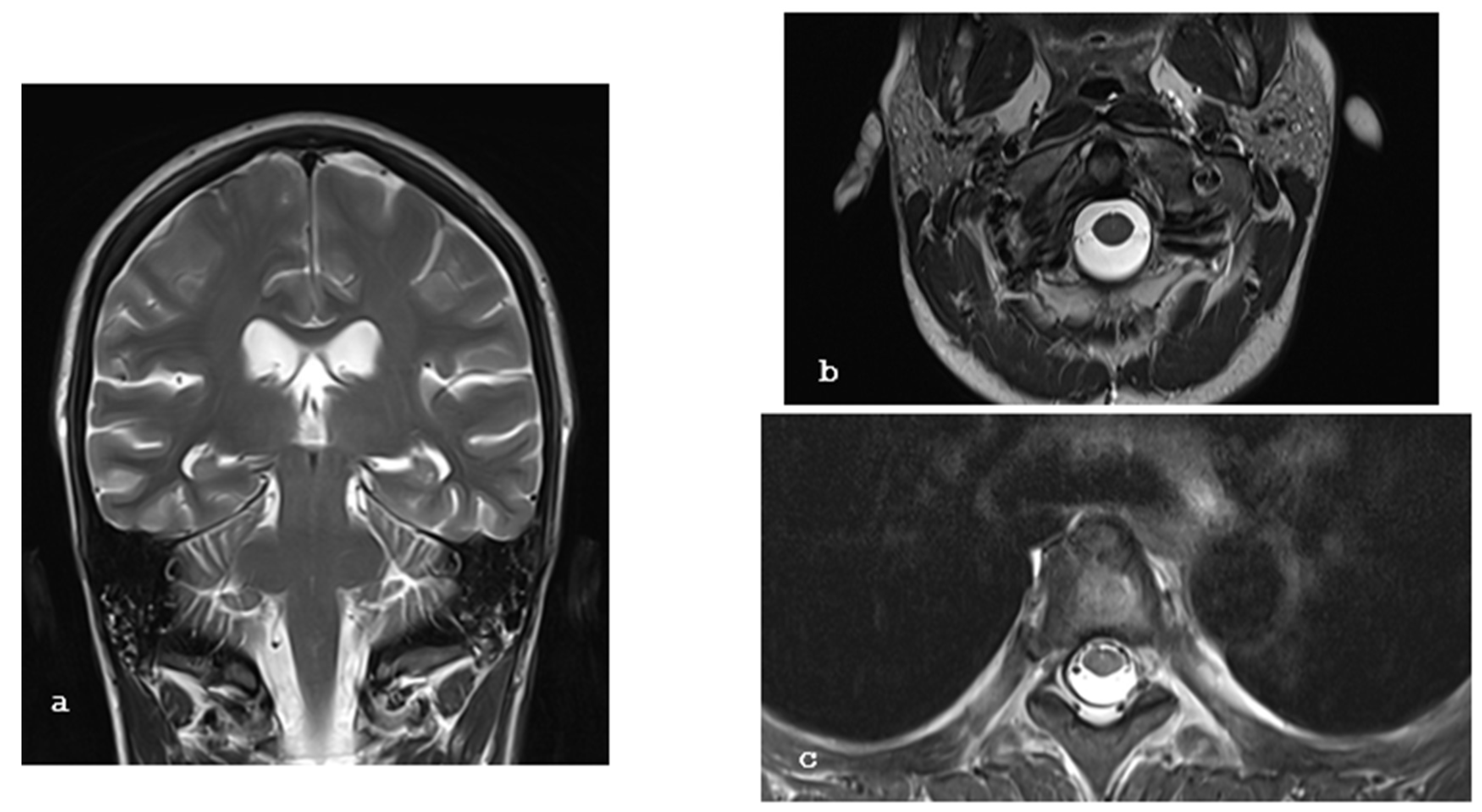 Brainsci 15 00296 g005 Brainsci 15 00296 g005