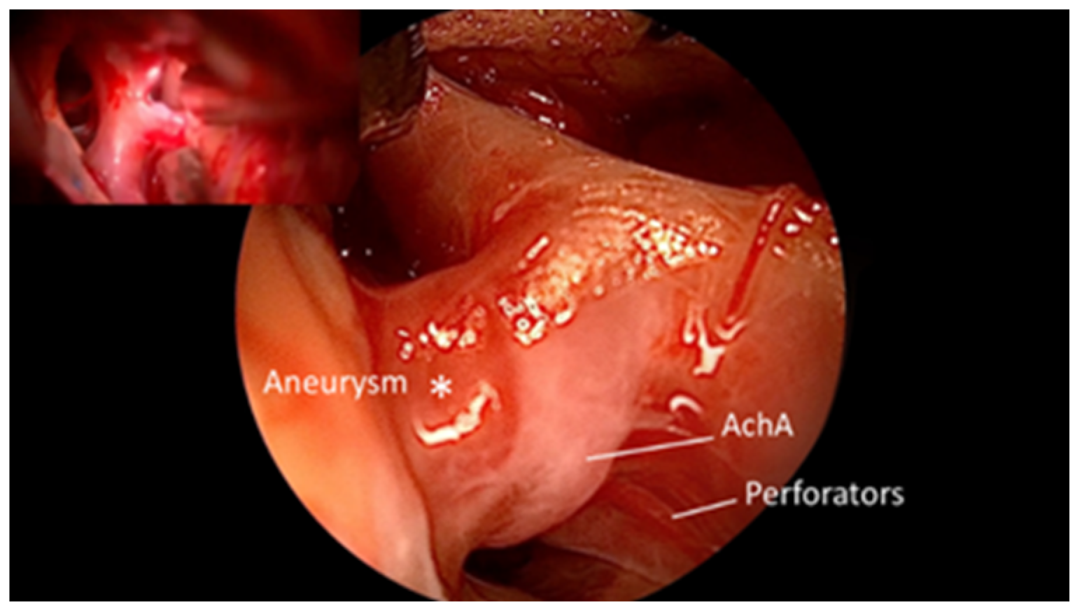 Brainsci 15 00300 g002