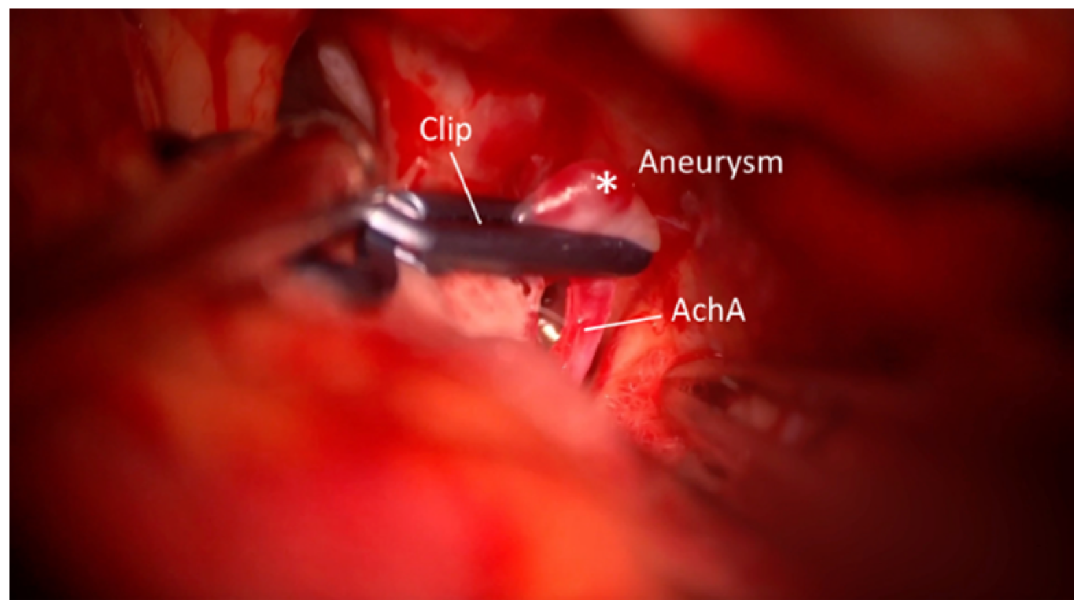 Brainsci 15 00300 g003