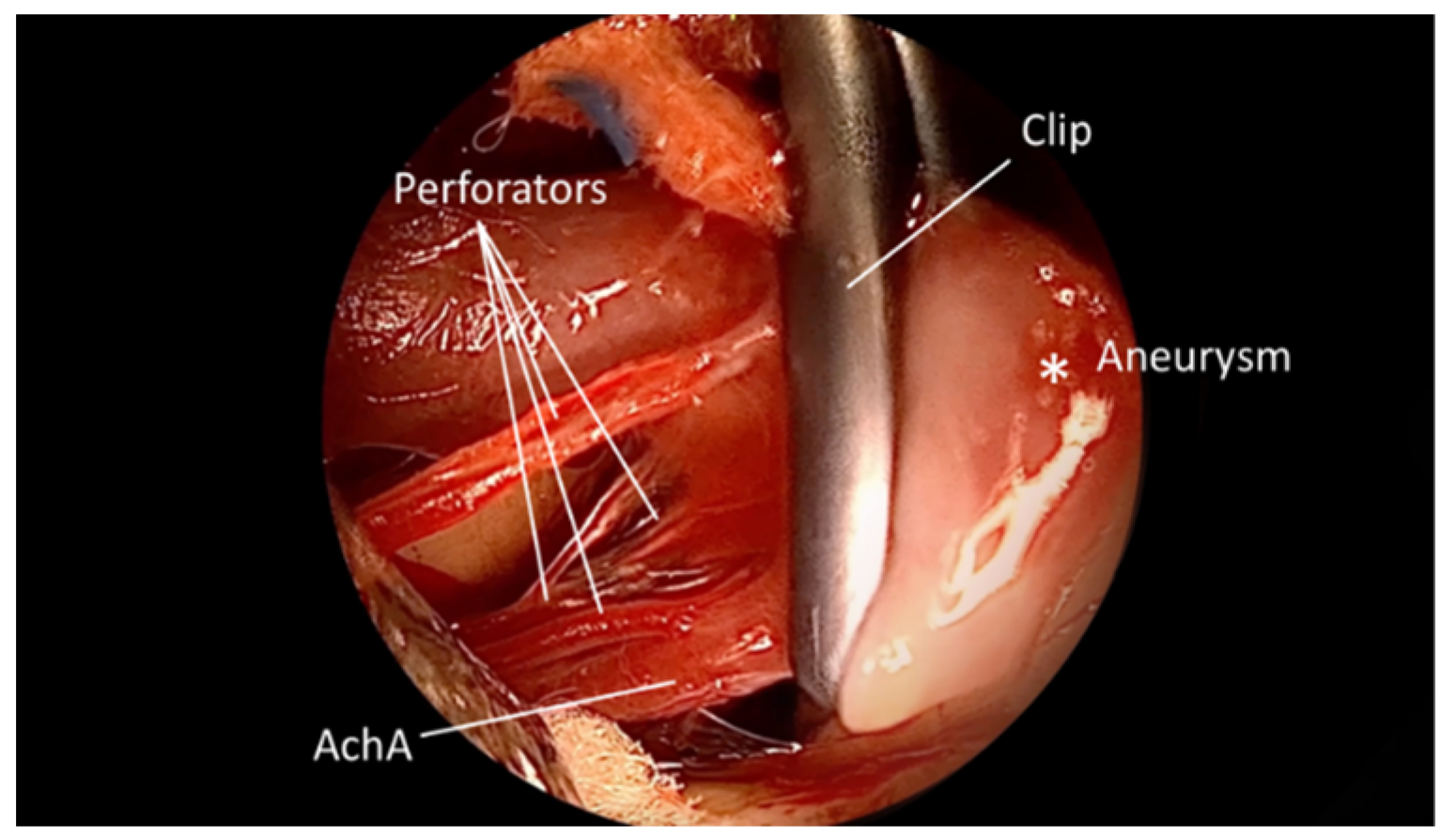 Brainsci 15 00300 g004