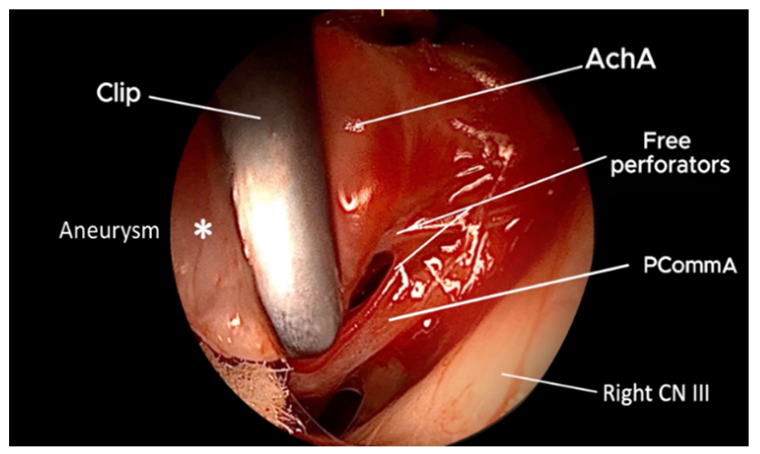 Brainsci 15 00300 g005